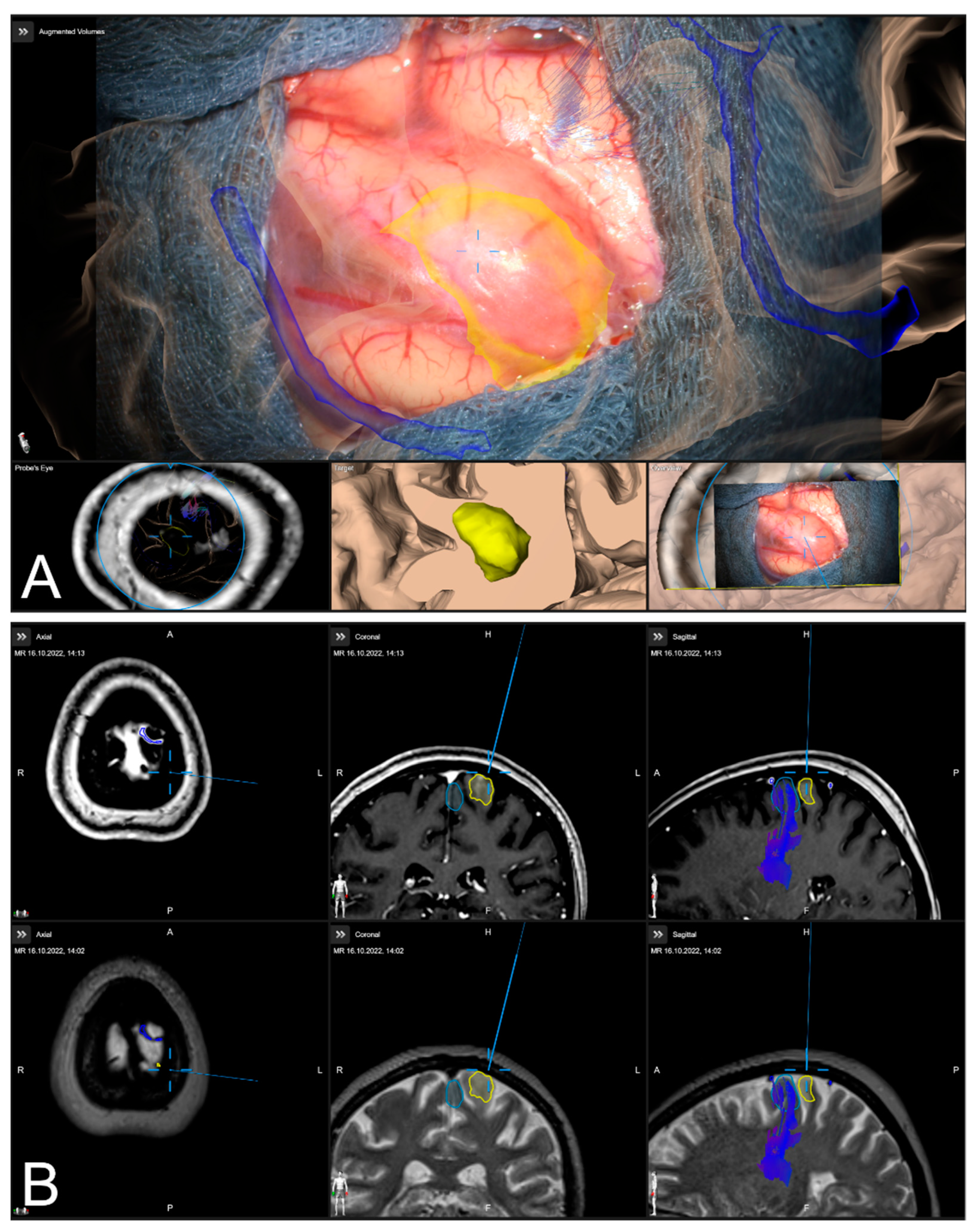 Sensors 22 09591 g003