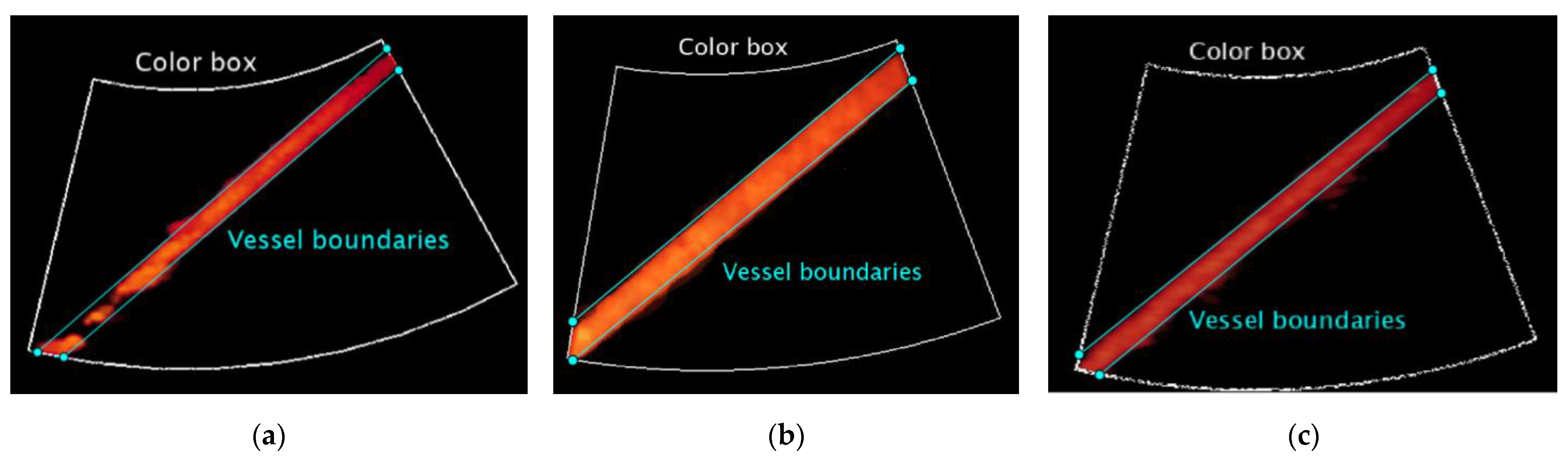 Sensors 22 09868 g004