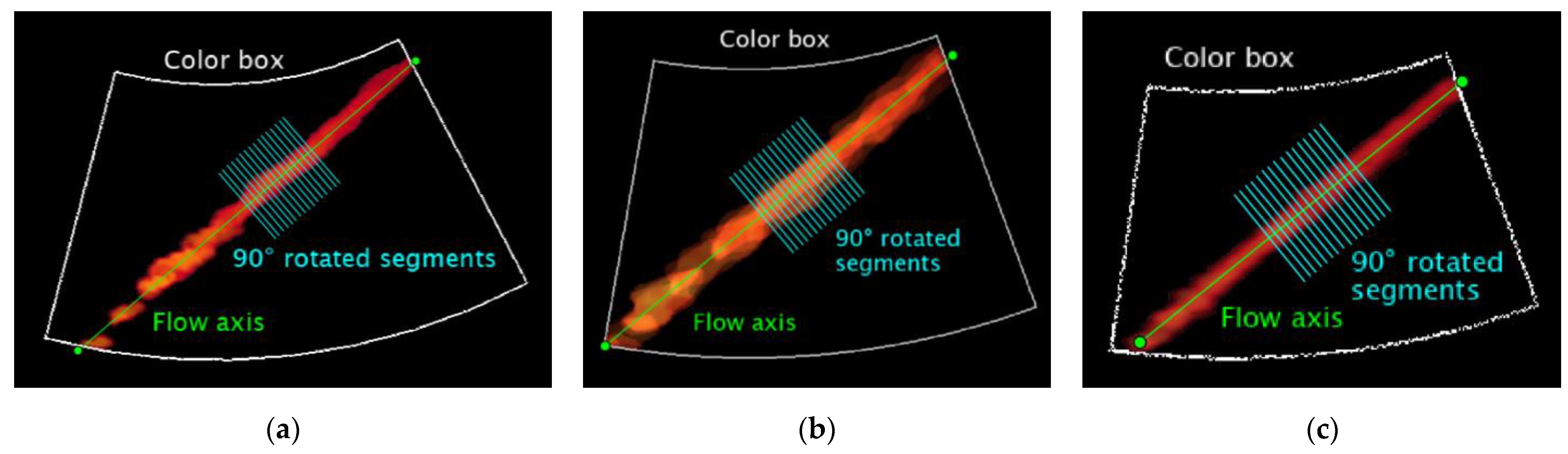 Sensors 22 09868 g006
