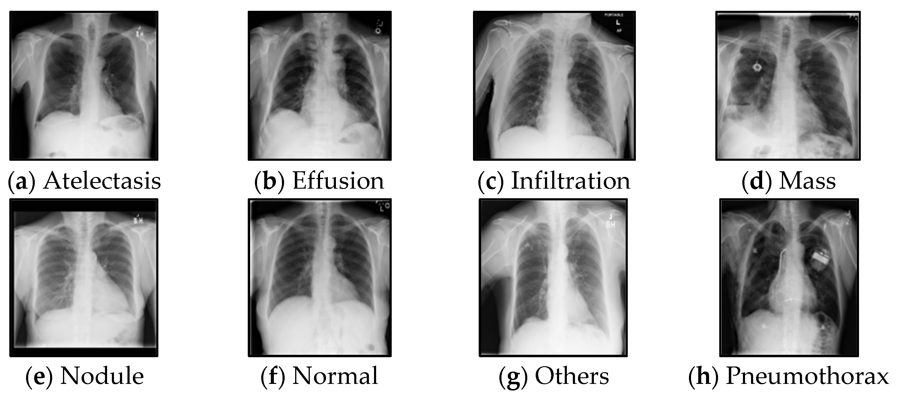 Sensors | Free Full-Text | Medical Image Classification Based on Semi ...