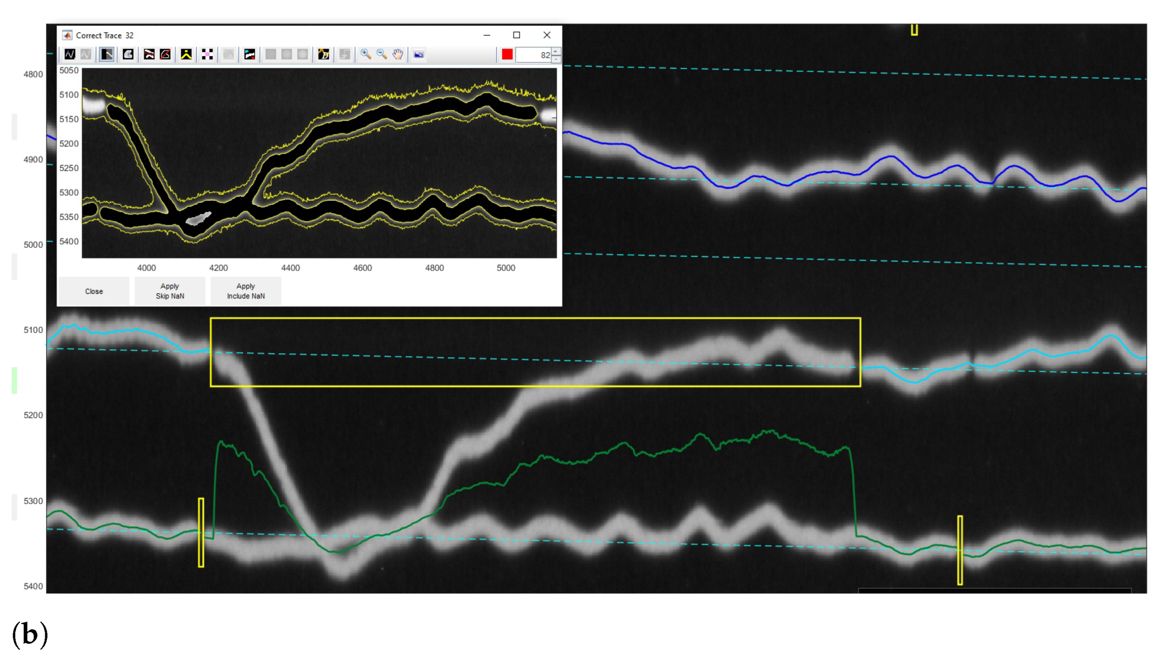 Sensors 23 00056 g014b Sensors 23 00056 g014b