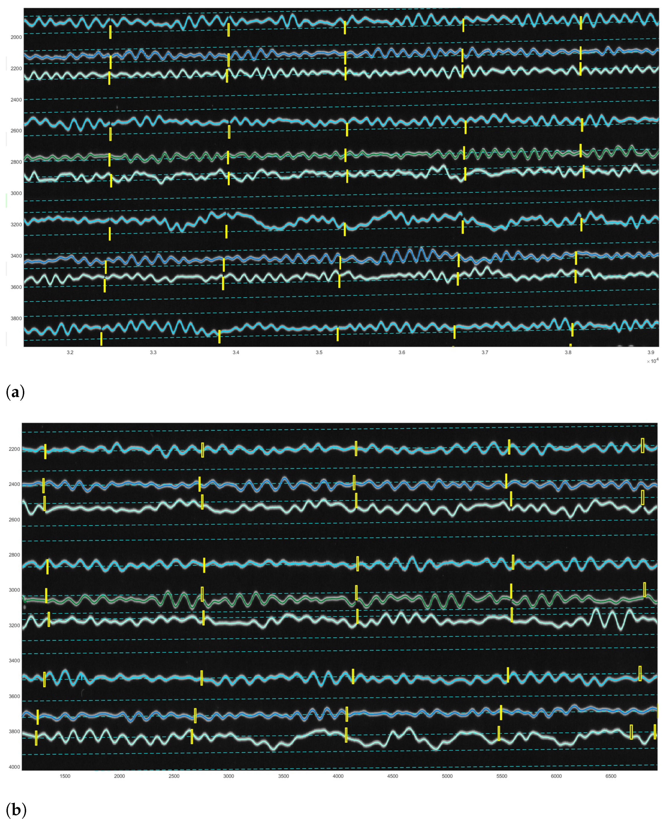 Sensors 23 00056 g019 Sensors 23 00056 g019