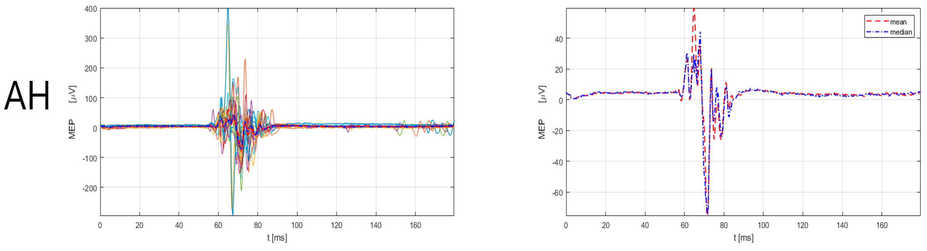 Sensors 23 00497 g004 Sensors 23 00497 g004