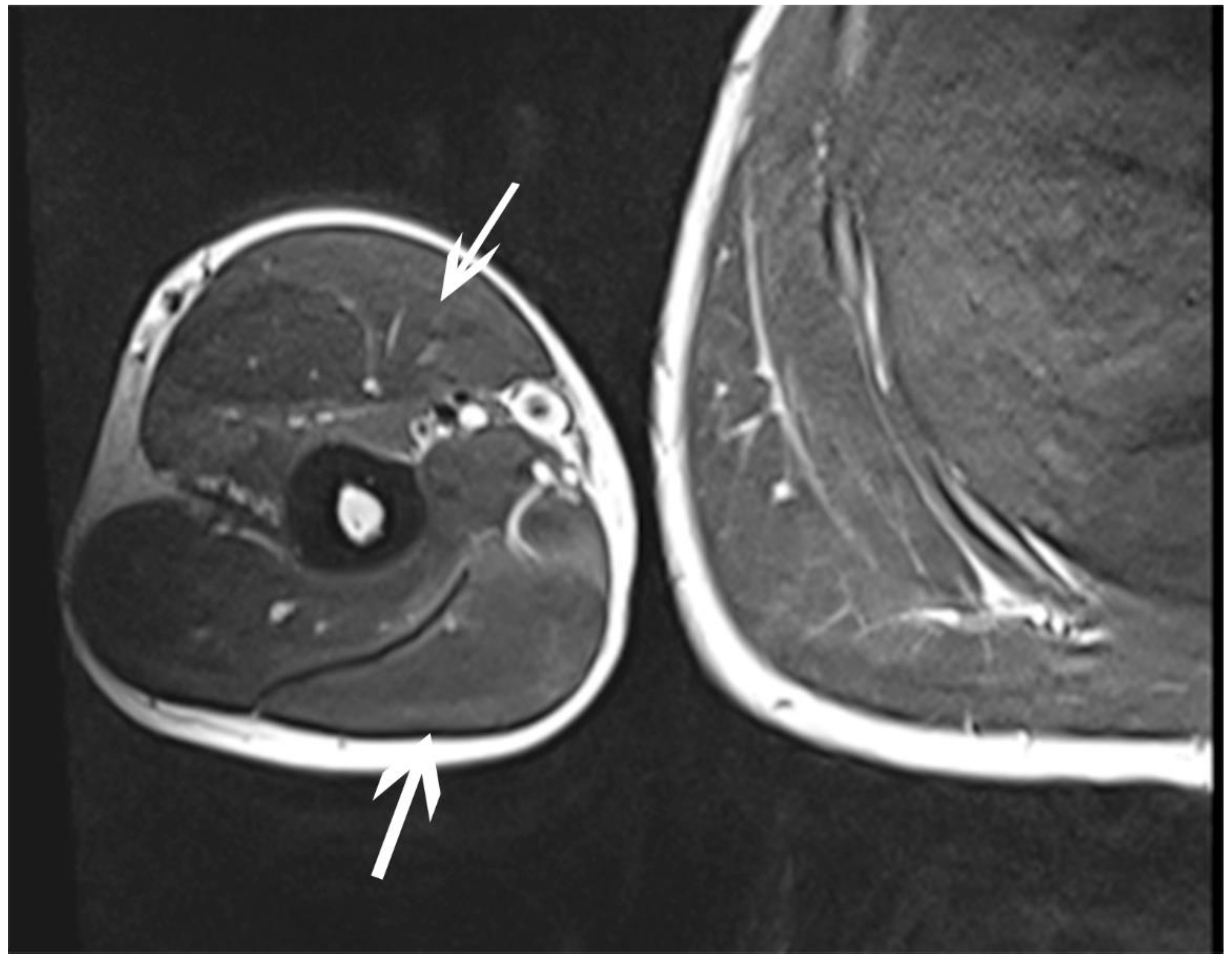 Sensors 23 00501 g003