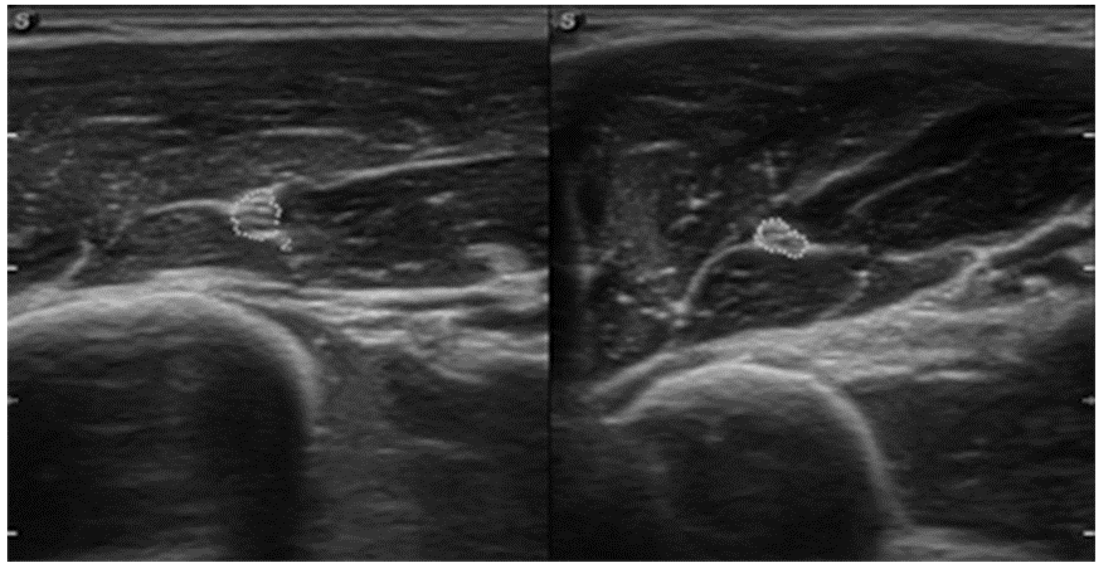 Sensors 23 00501 g004