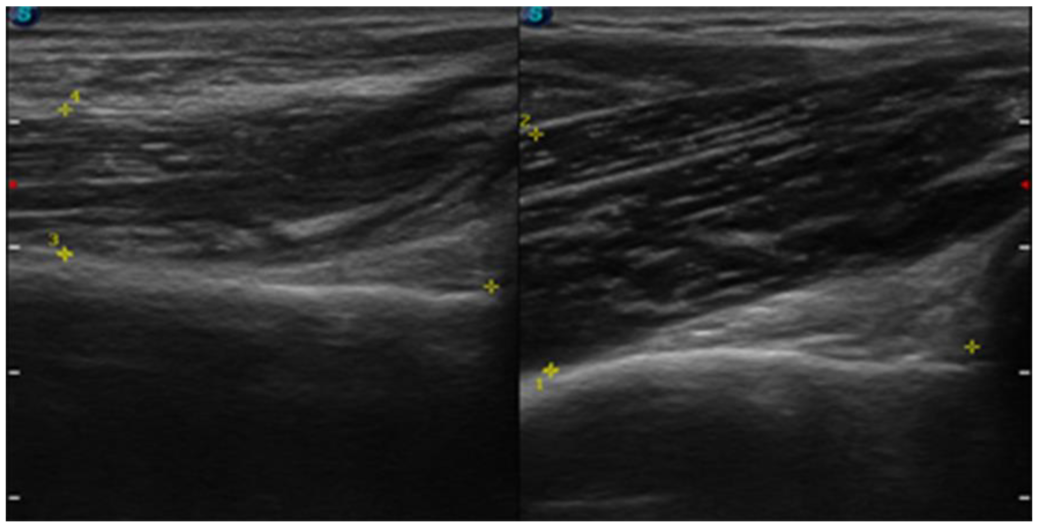 Sensors 23 00501 g005