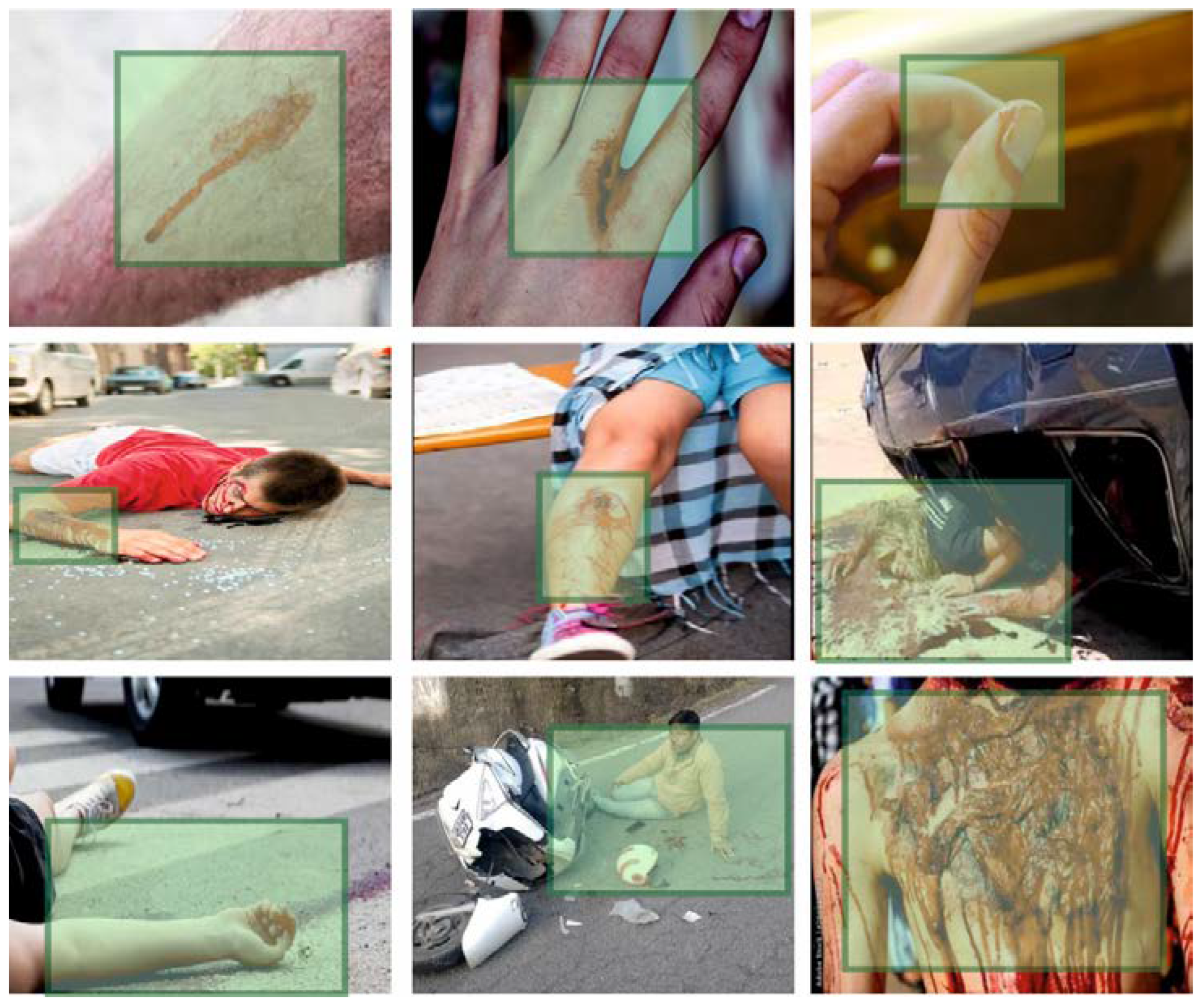 Sensors 23 00519 g003 Sensors 23 00519 g003