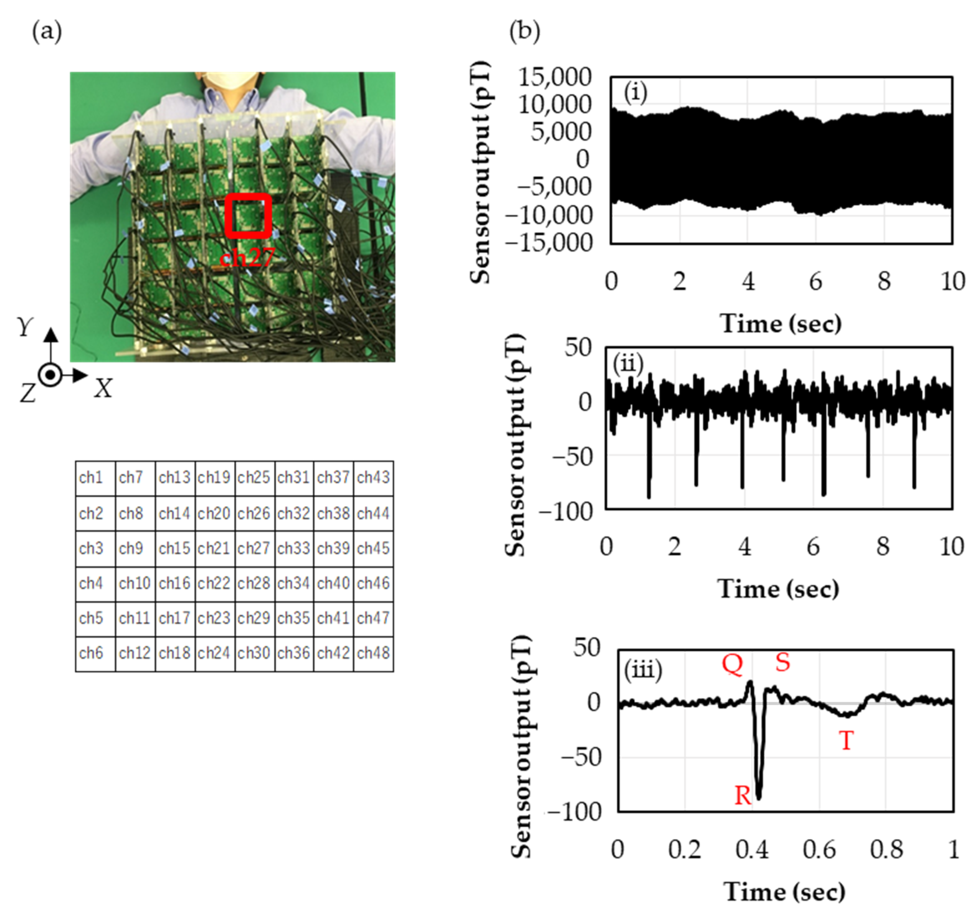 Sensors 23 00646 g004