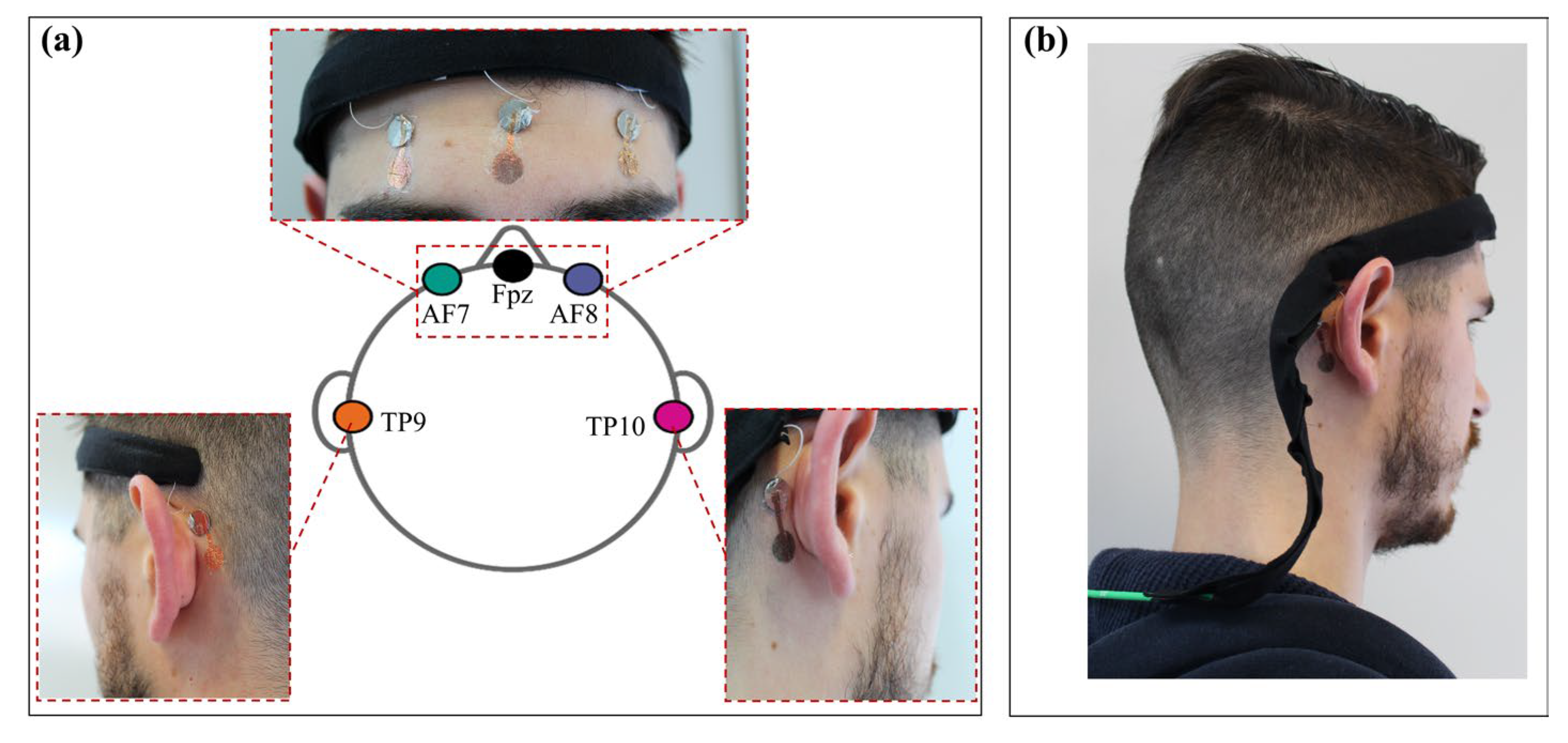 Sensors Free FullText Wearable System Based on UltraThin Parylene