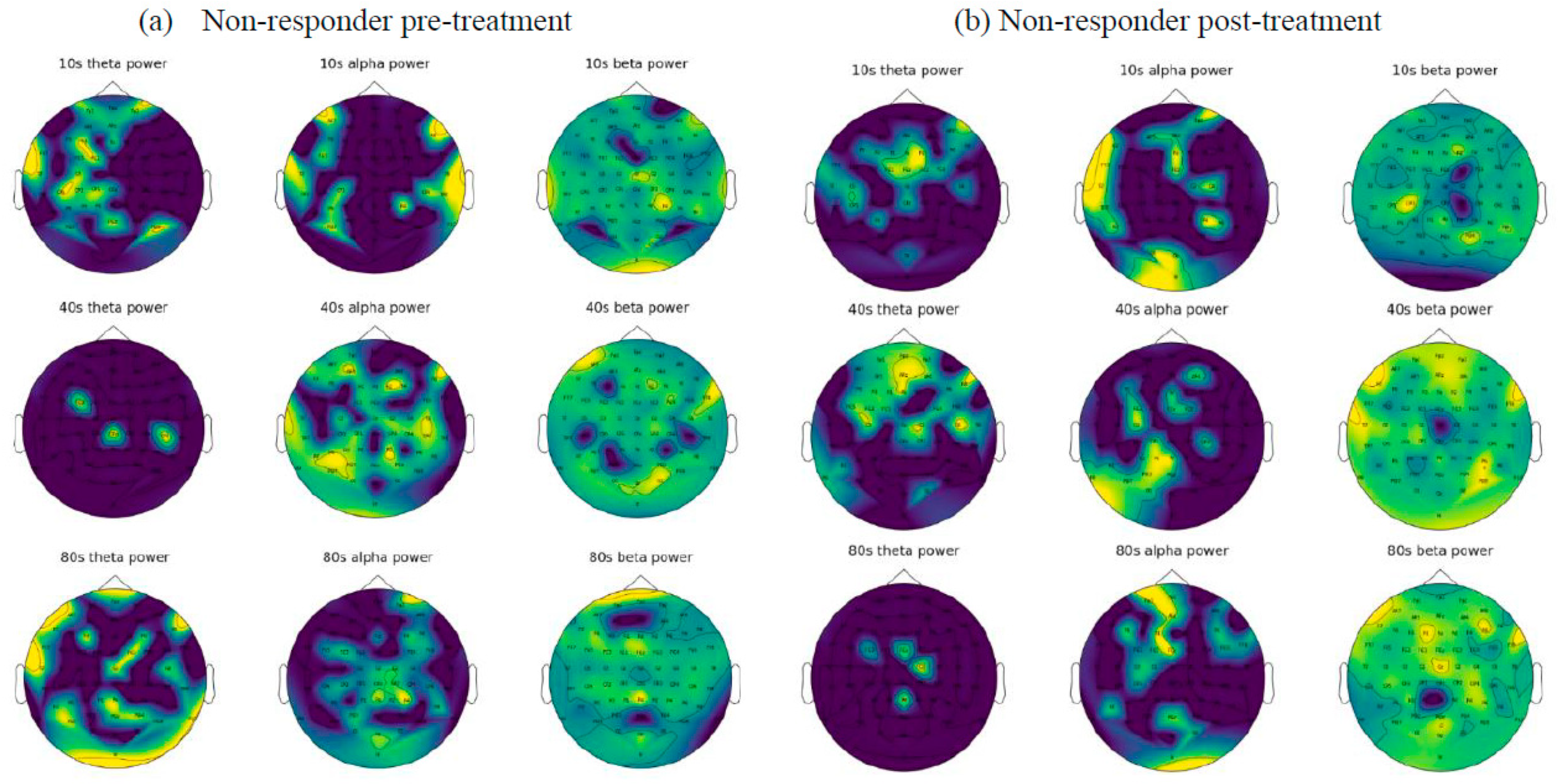 Sensors 23 00902 g005