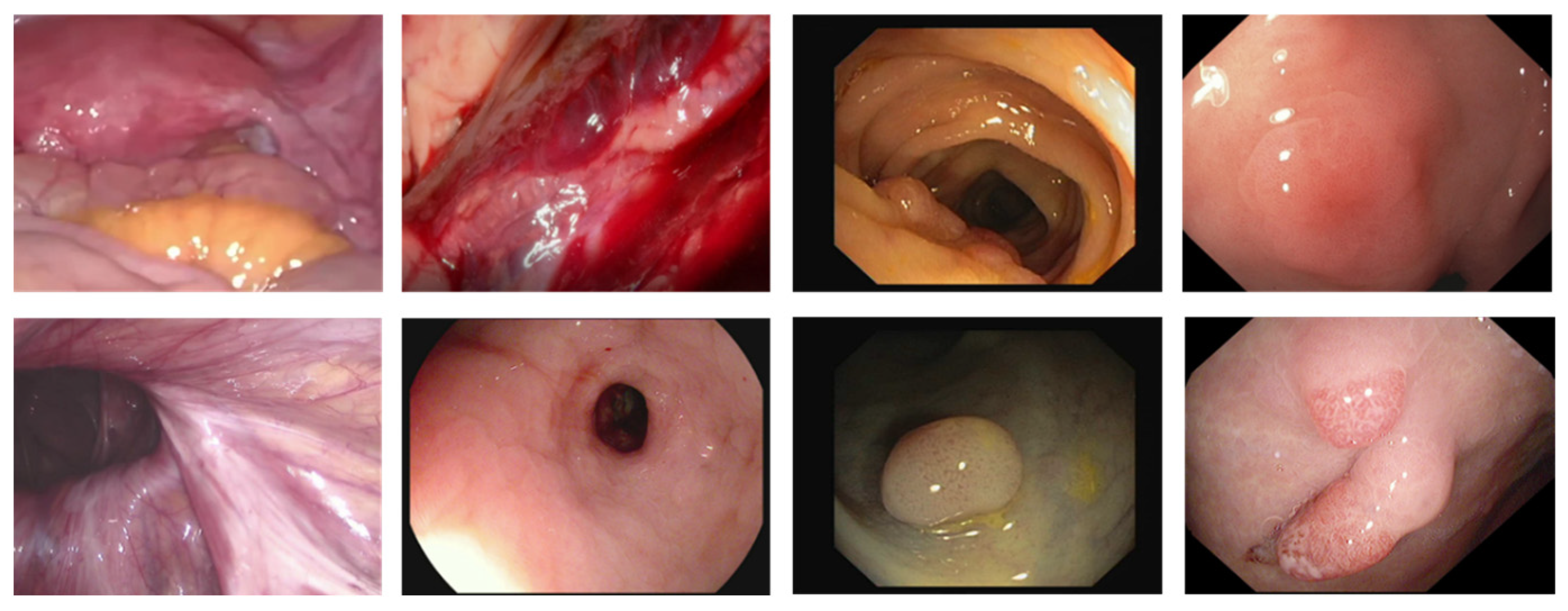 Sensors 23 00974 g001