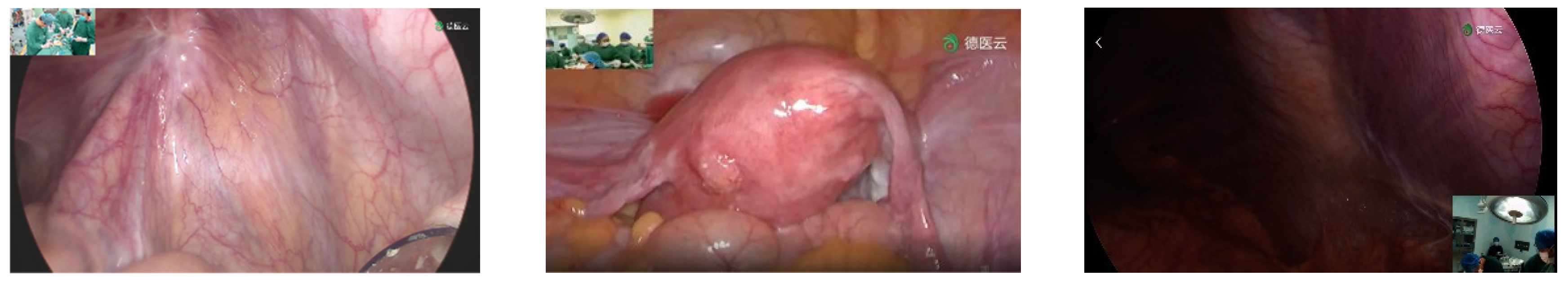 Sensors 23 00974 g003a