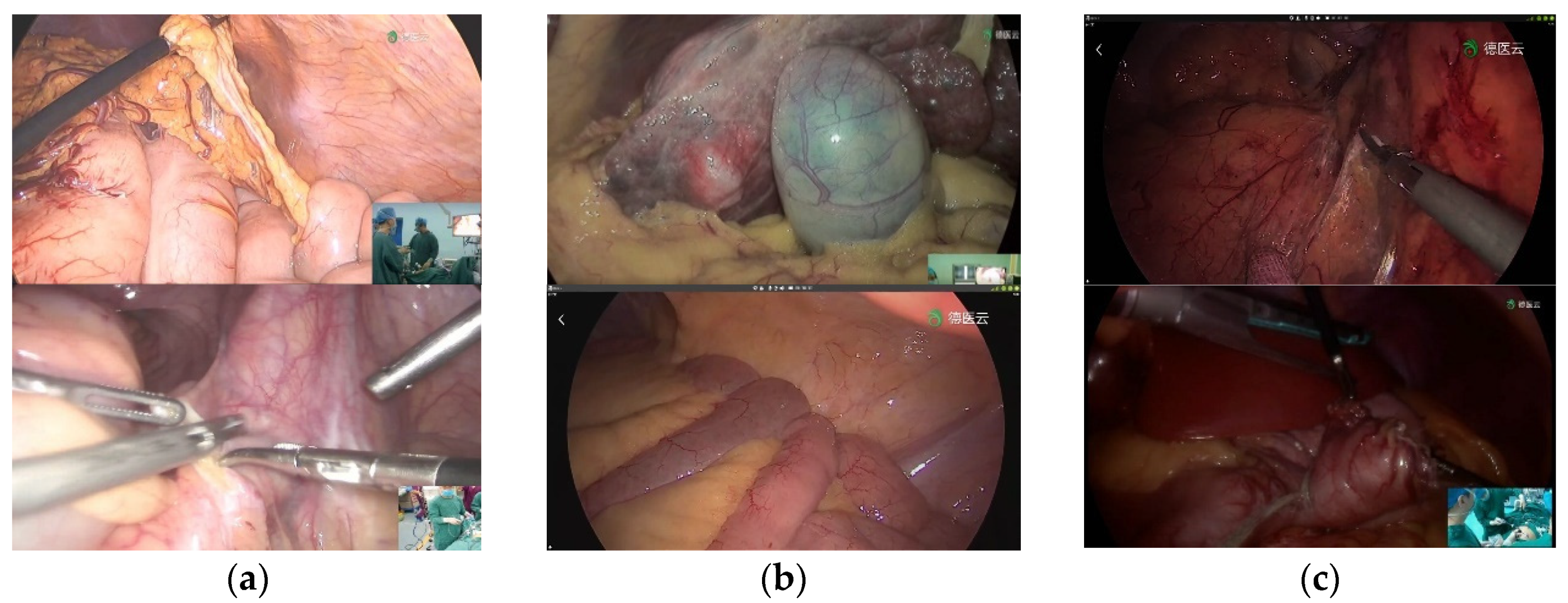 Sensors 23 00974 g003b