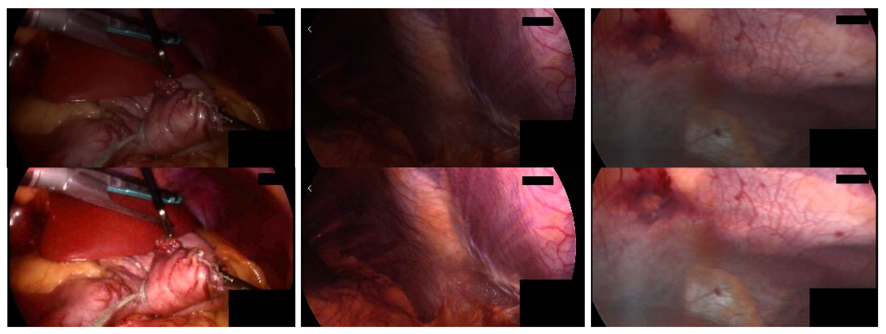 Sensors 23 00974 g004