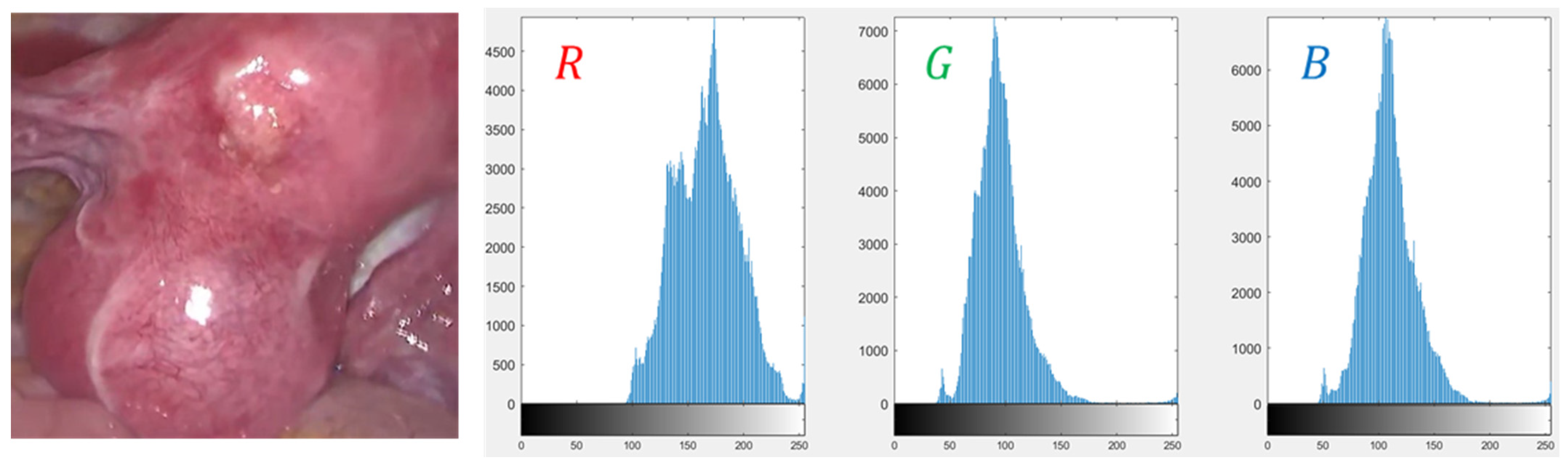 Sensors 23 00974 g005