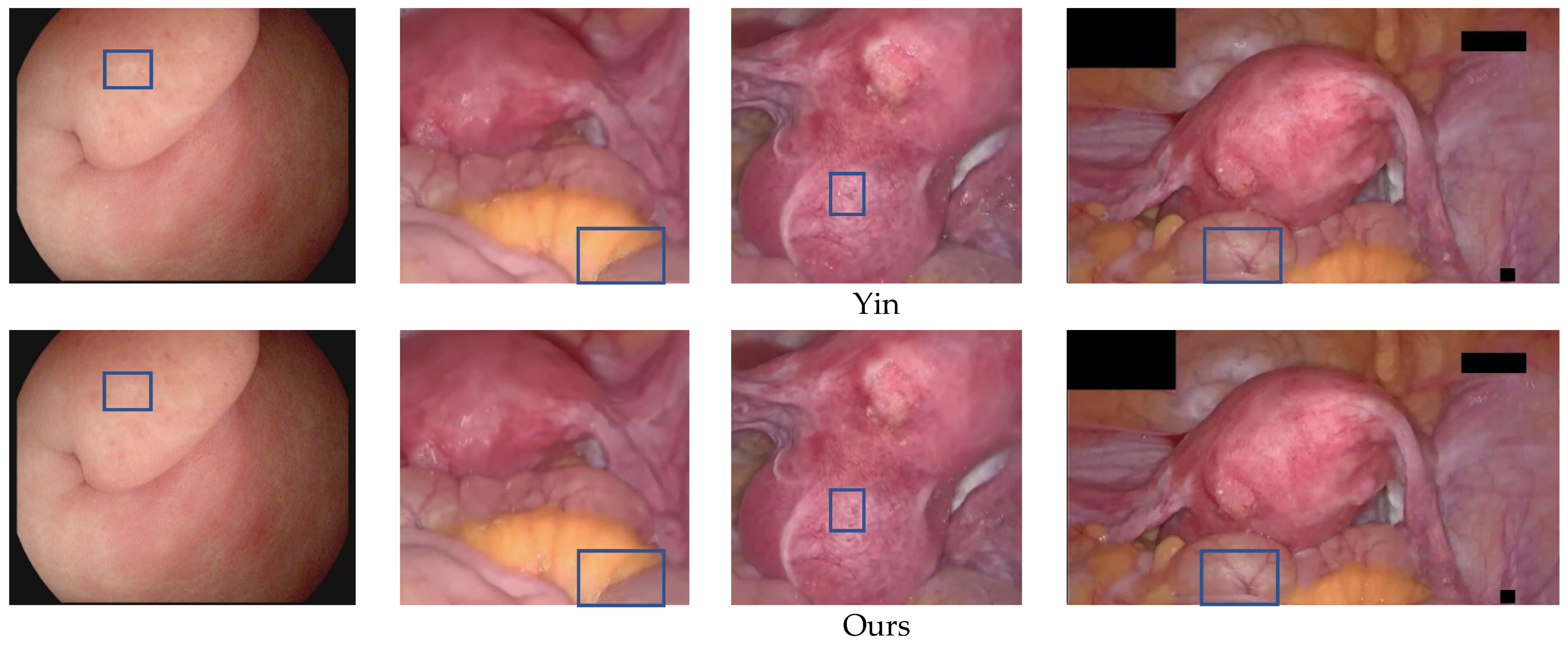 Sensors 23 00974 g012c