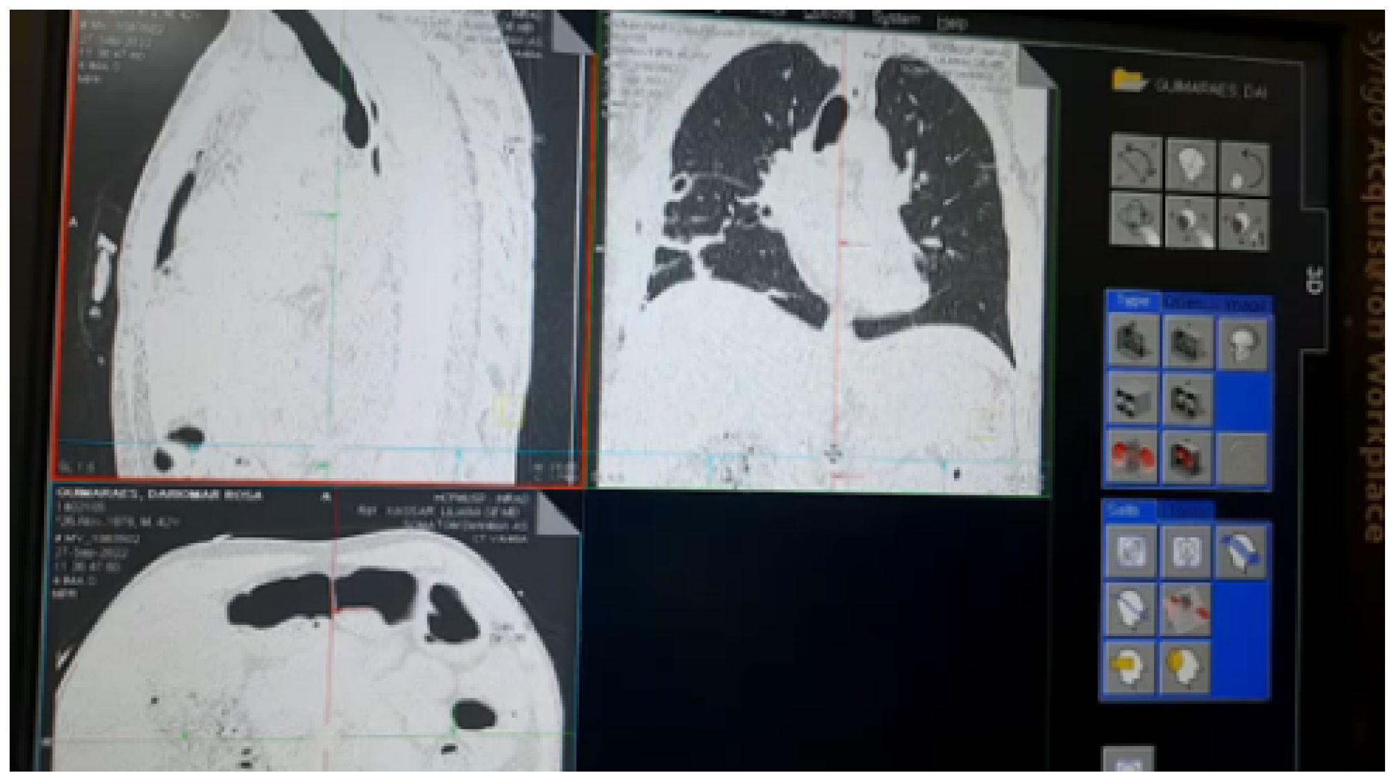 Sensors 23 01047 g018