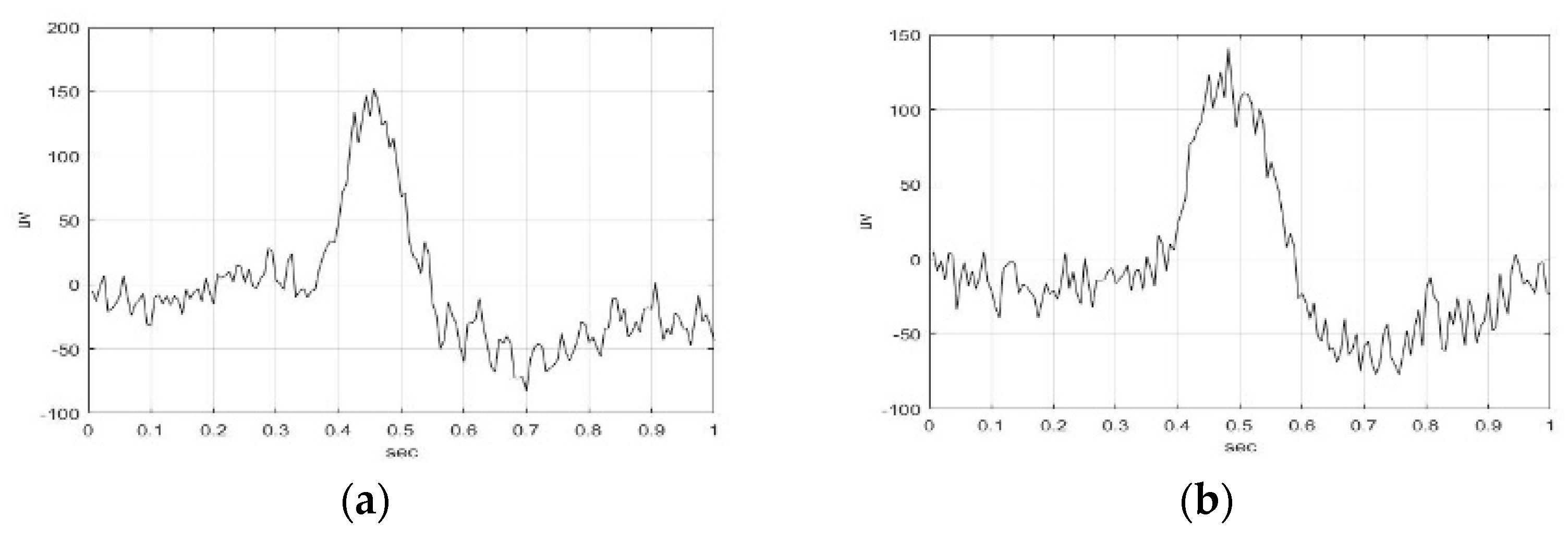 Sensors 23 01078 g002a Sensors 23 01078 g002a