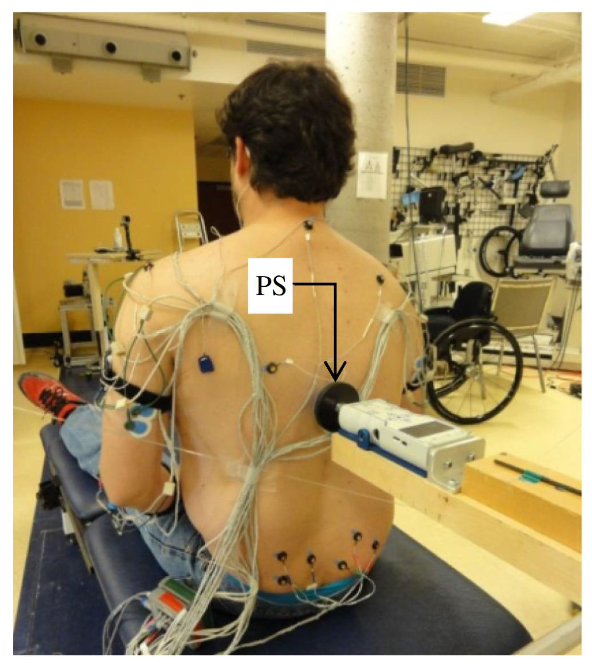 Sensors Free Full-Text Sensorimotor Time Delay Estimation by EMG Signal Processing in People Living with Spinal Cord Injury