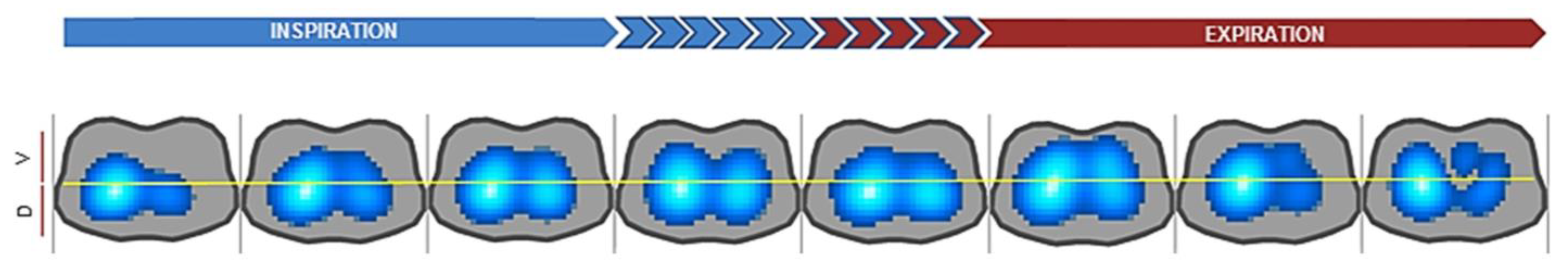 Sensors 23 01182 g002 Sensors 23 01182 g002
