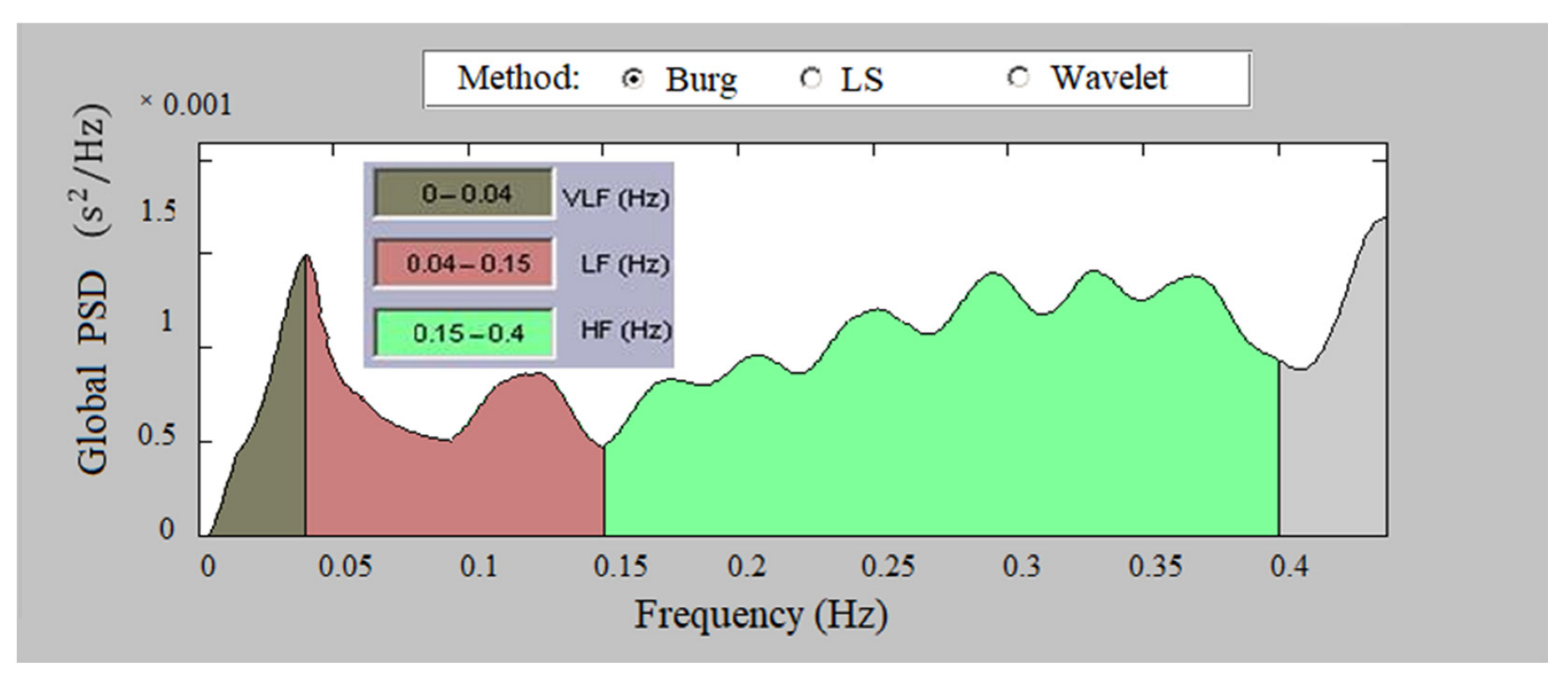 Sensors 23 01186 g009 Sensors 23 01186 g009