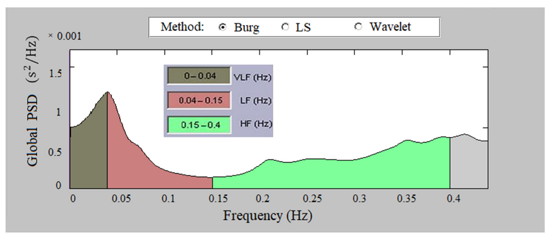 Sensors 23 01186 g010 Sensors 23 01186 g010