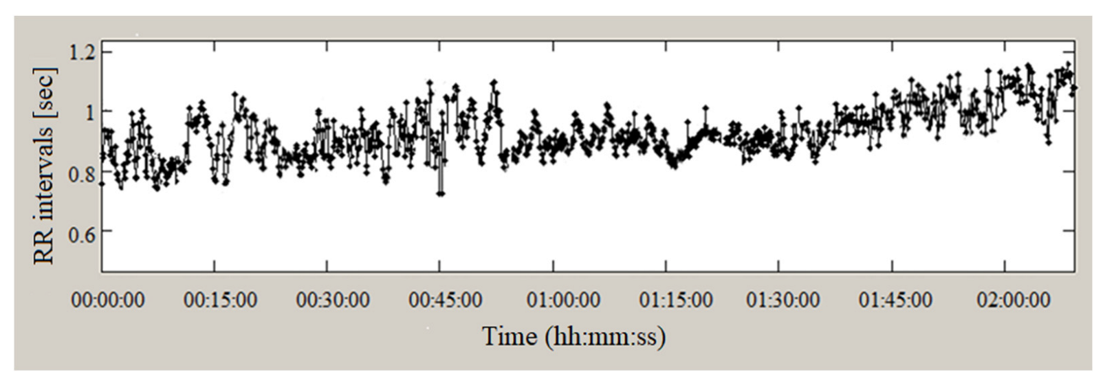 Sensors 23 01186 g014 Sensors 23 01186 g014