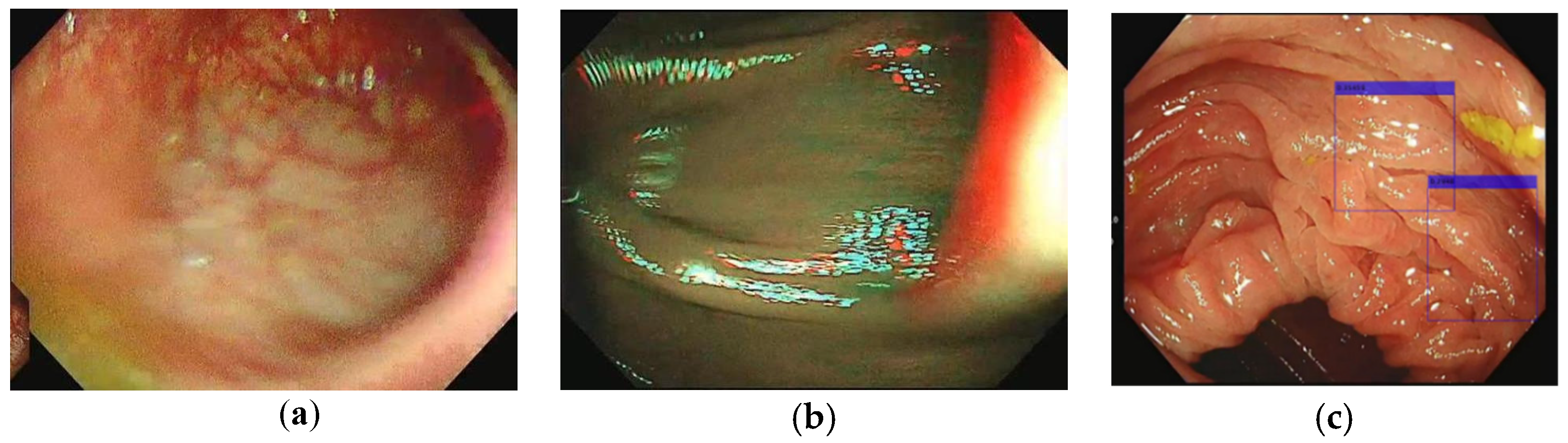 Sensors 23 01211 g001 Sensors 23 01211 g001