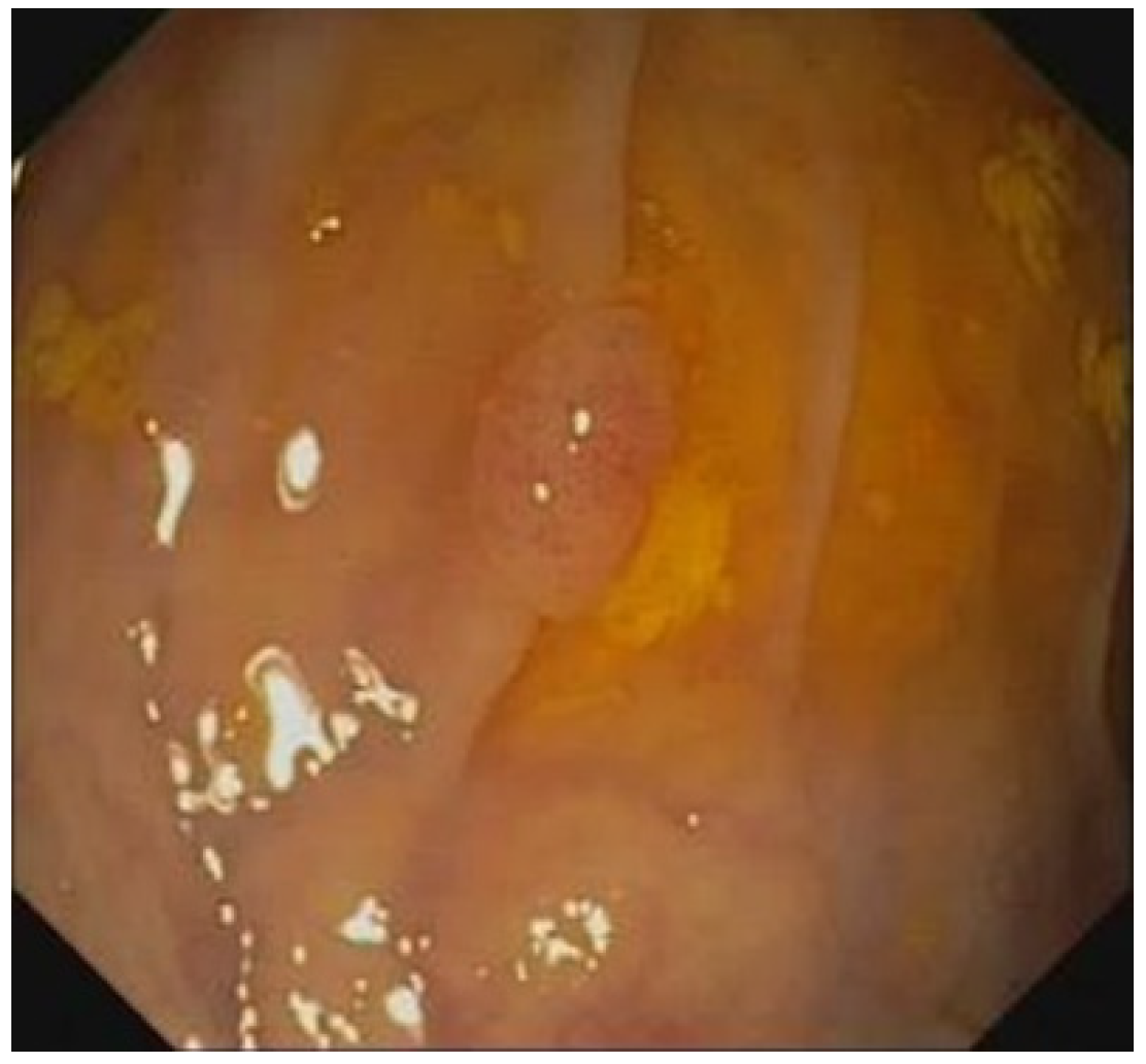 Sensors 23 01211 g005 Sensors 23 01211 g005