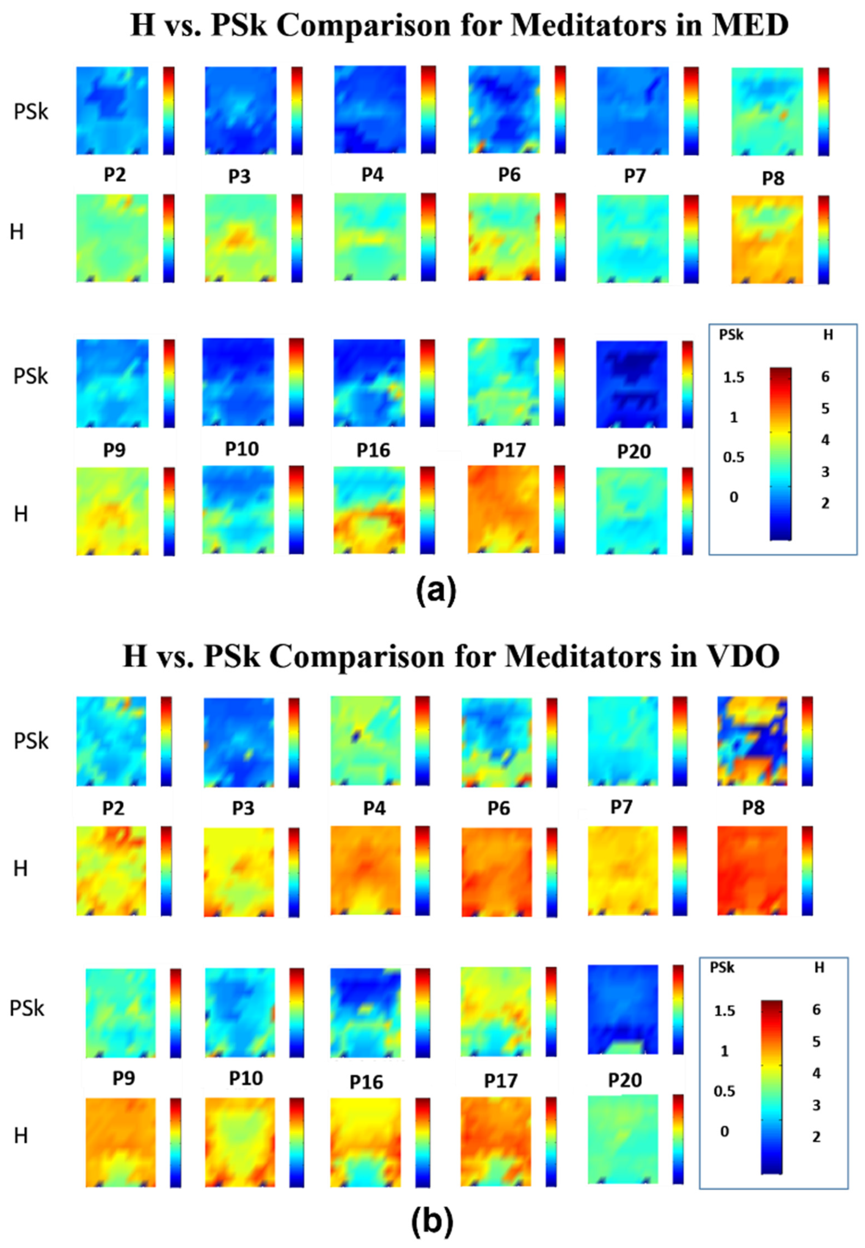 Sensors 23 01293 g004 Sensors 23 01293 g004