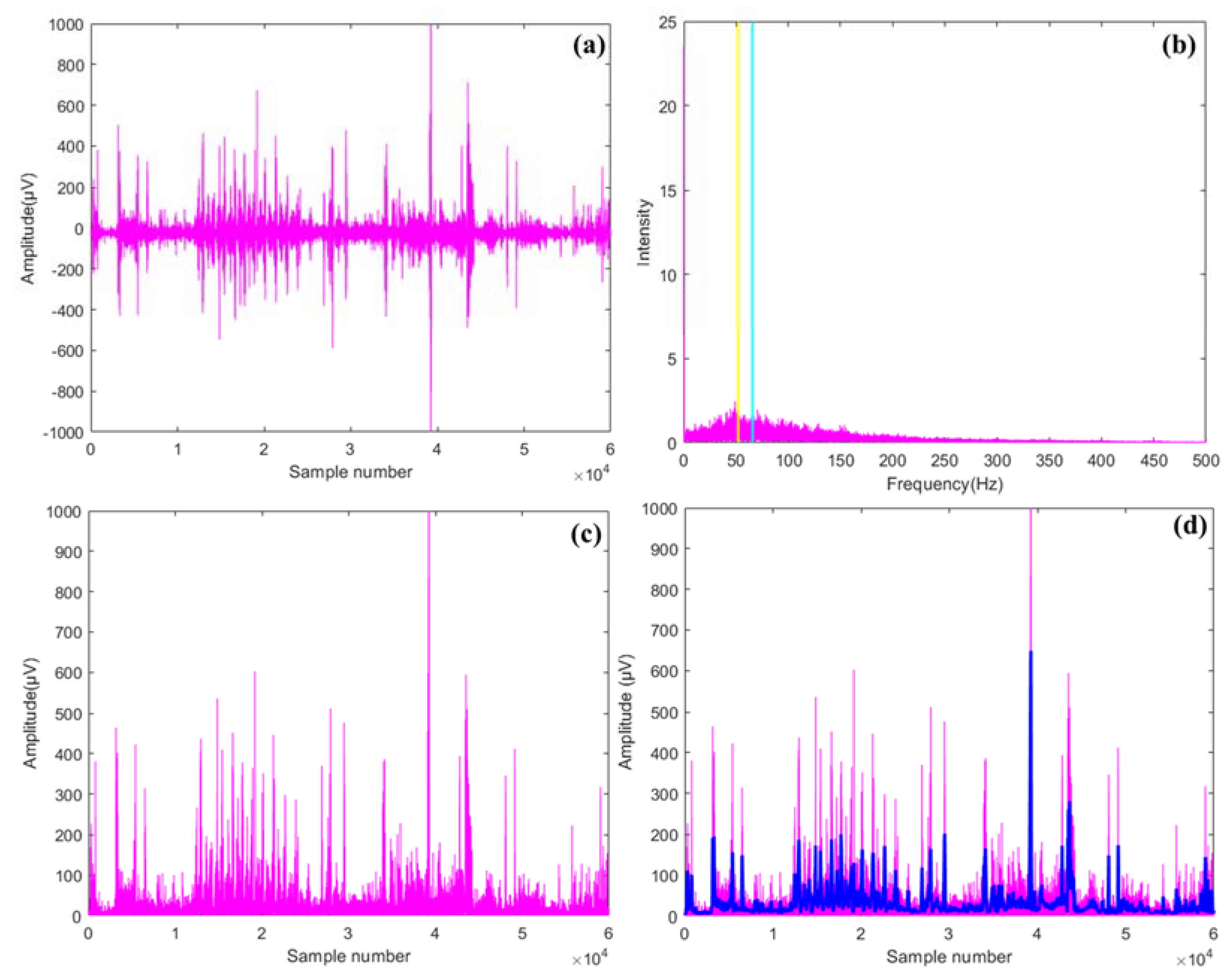 Sensors 23 01408 g003 Sensors 23 01408 g003
