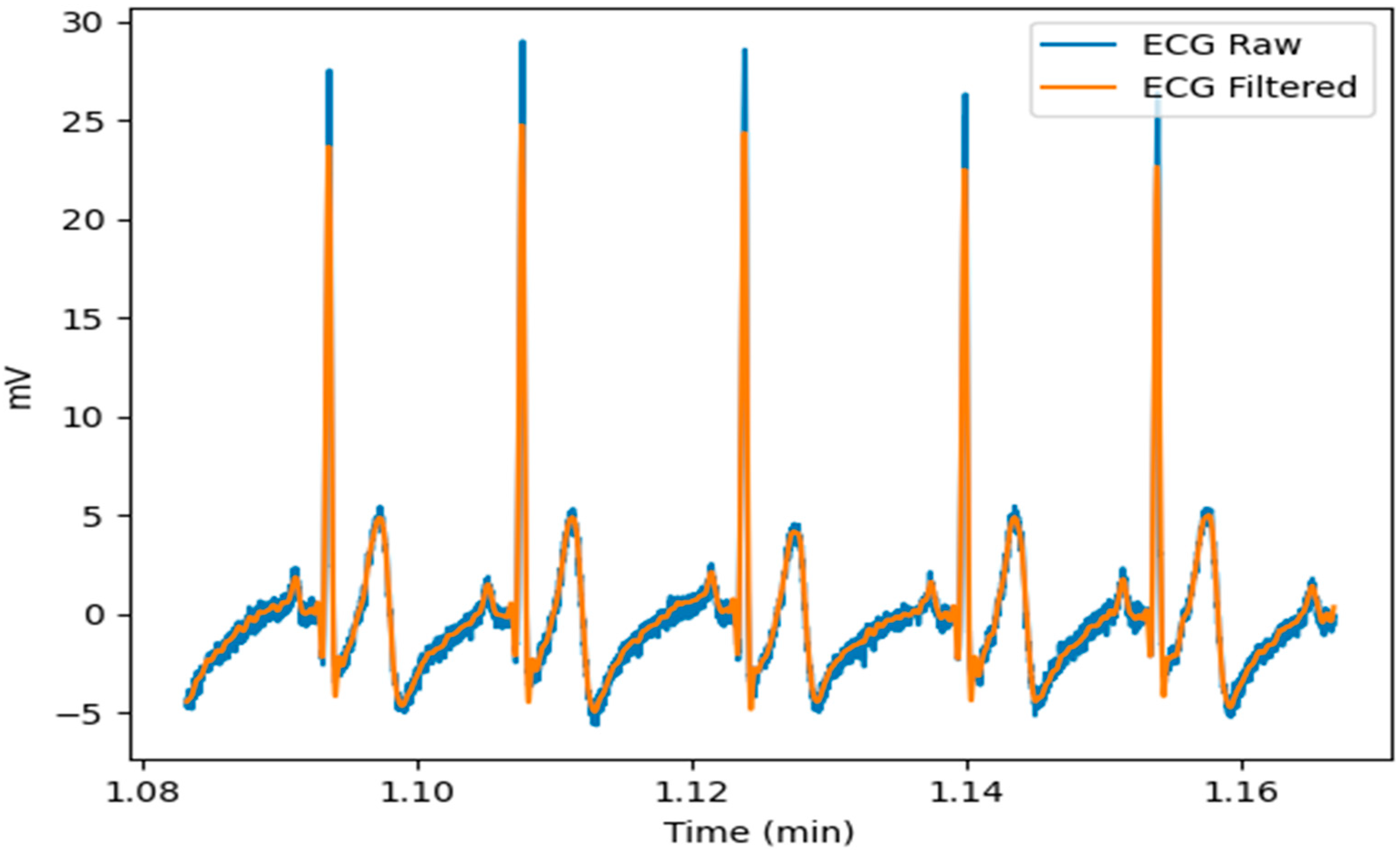 Sensors 23 01443 g004