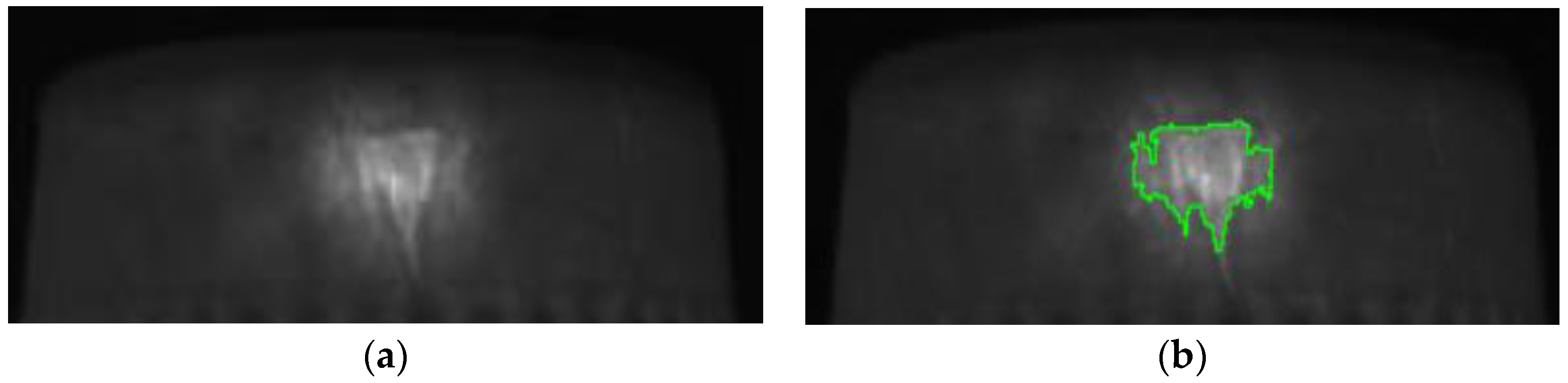 Sensors 23 01452 g023 550