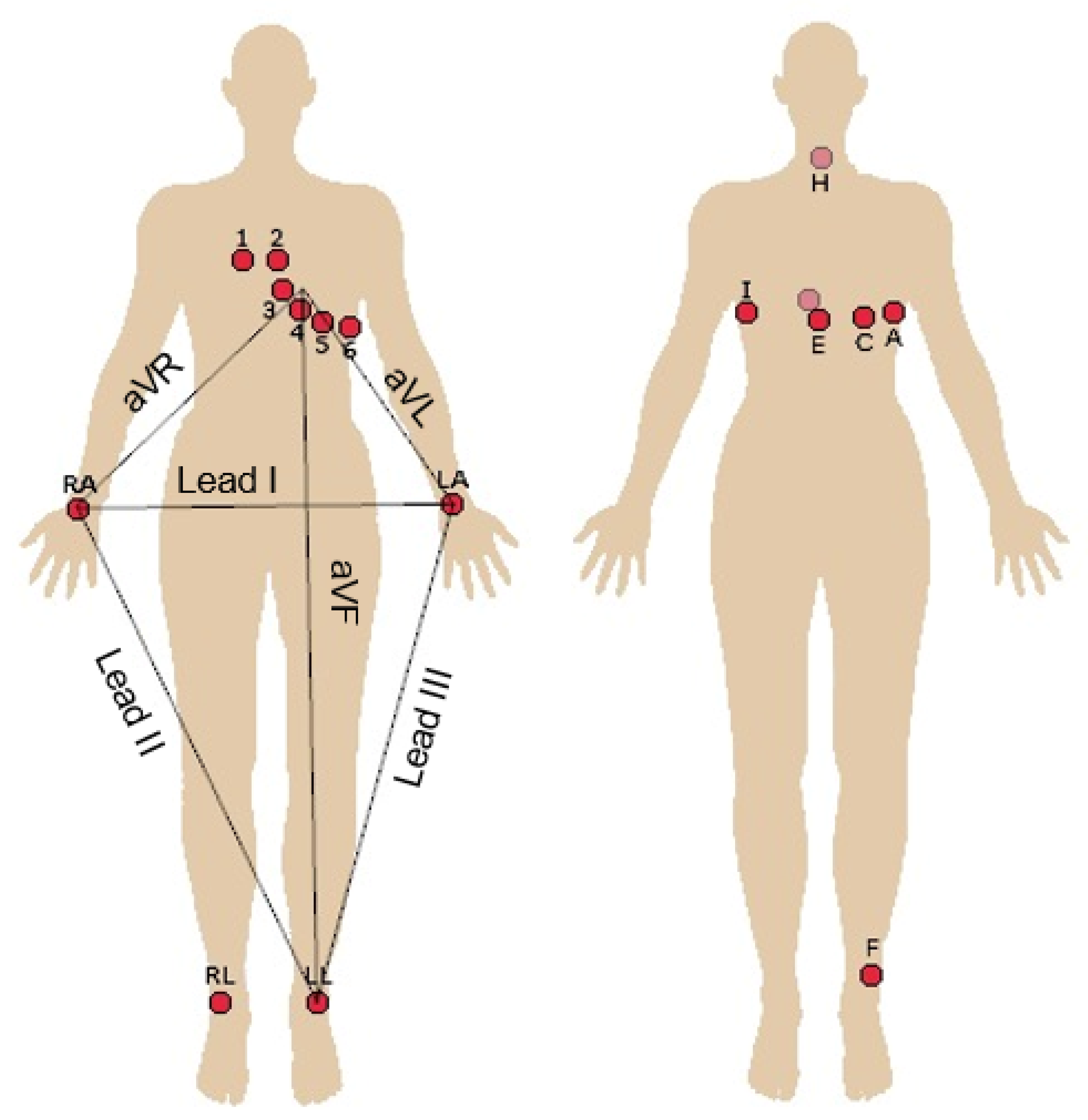 Sensors 23 01507 g004