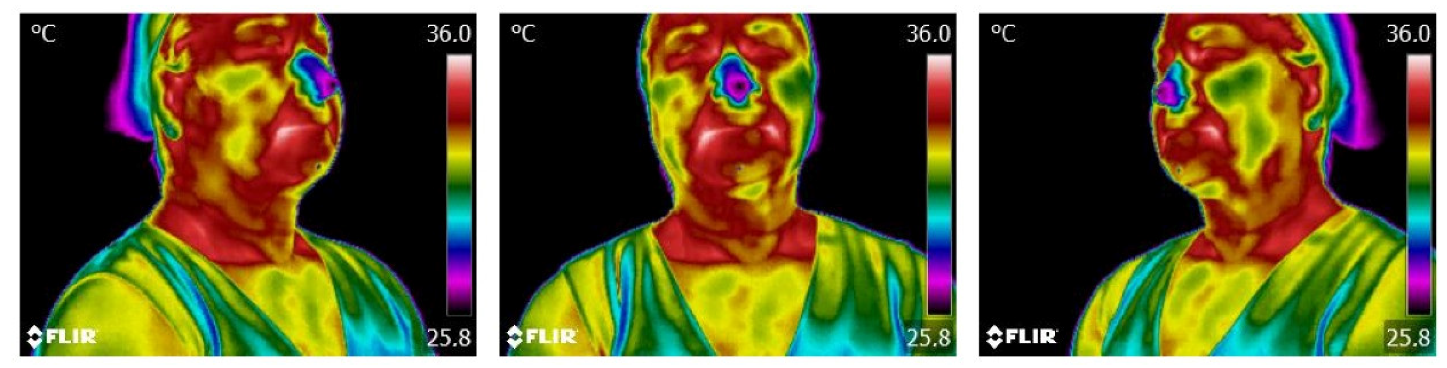 Sensors 23 01610 g006