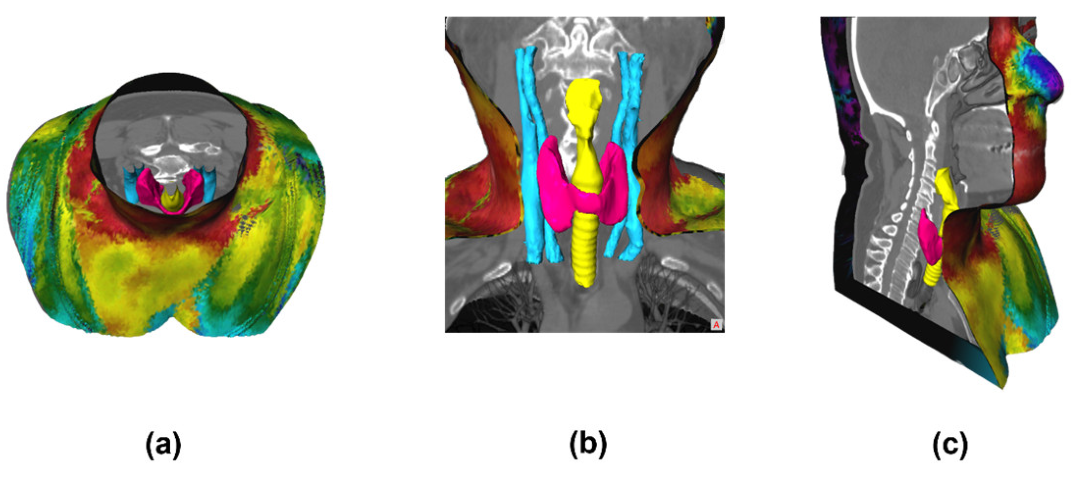 Sensors | Free Full-Text | 3D Multi-Modality Medical Imaging: Combining ...