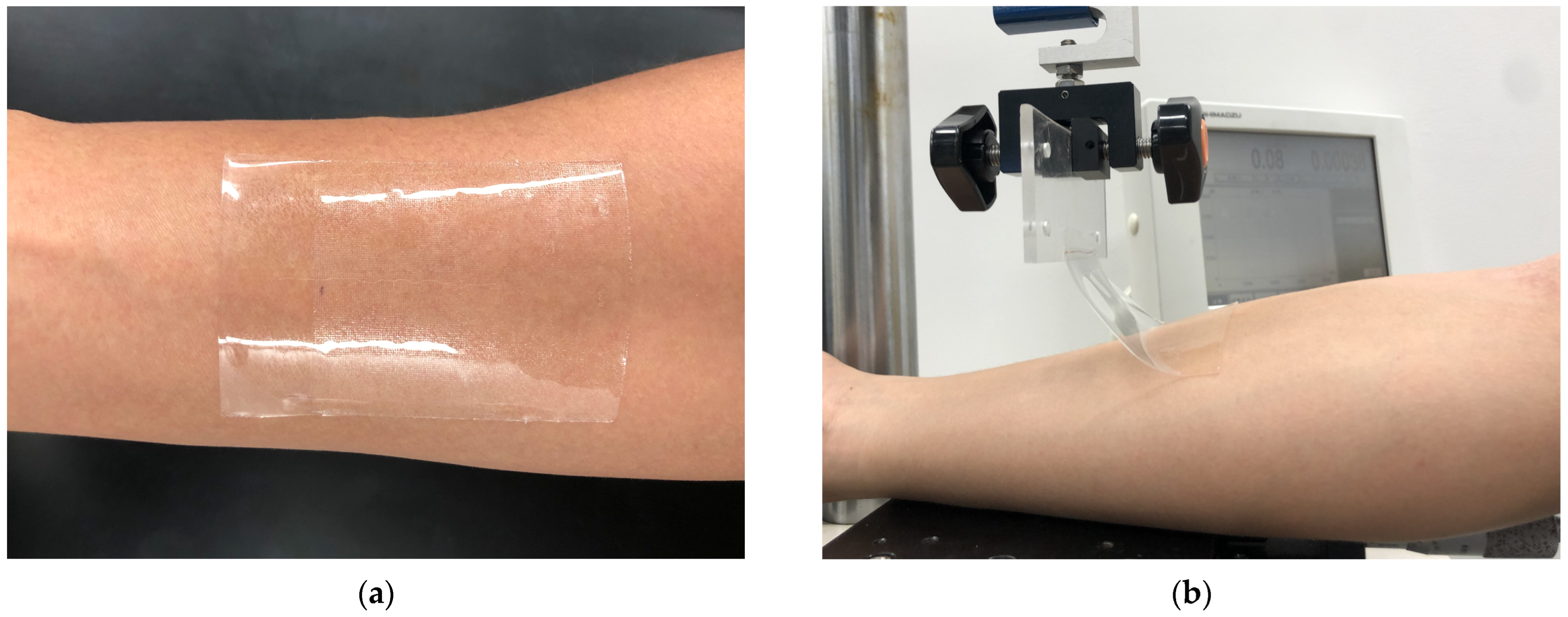 Sensors 23 01774 g005 Sensors 23 01774 g005