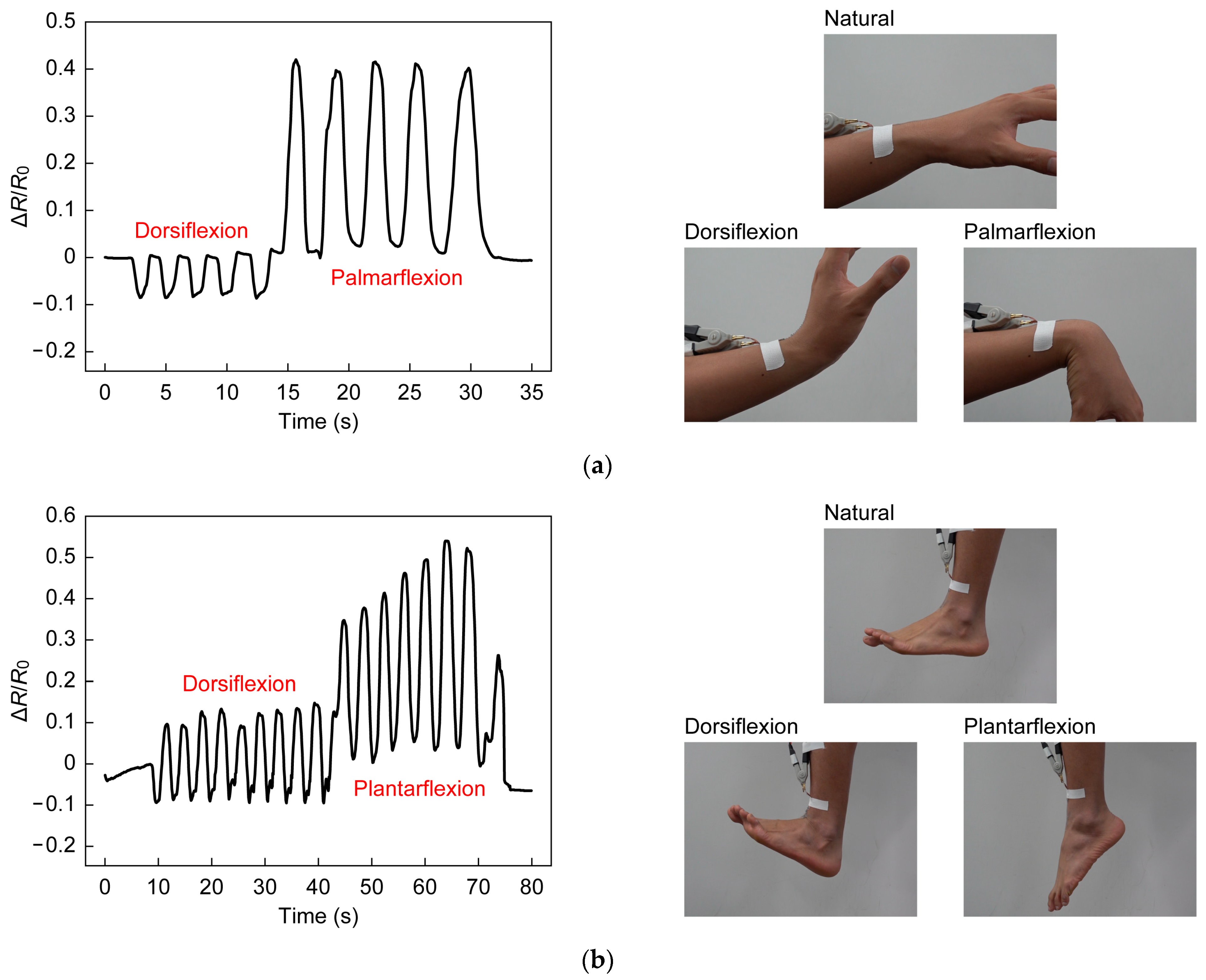 Sensors 23 01774 g011 Sensors 23 01774 g011