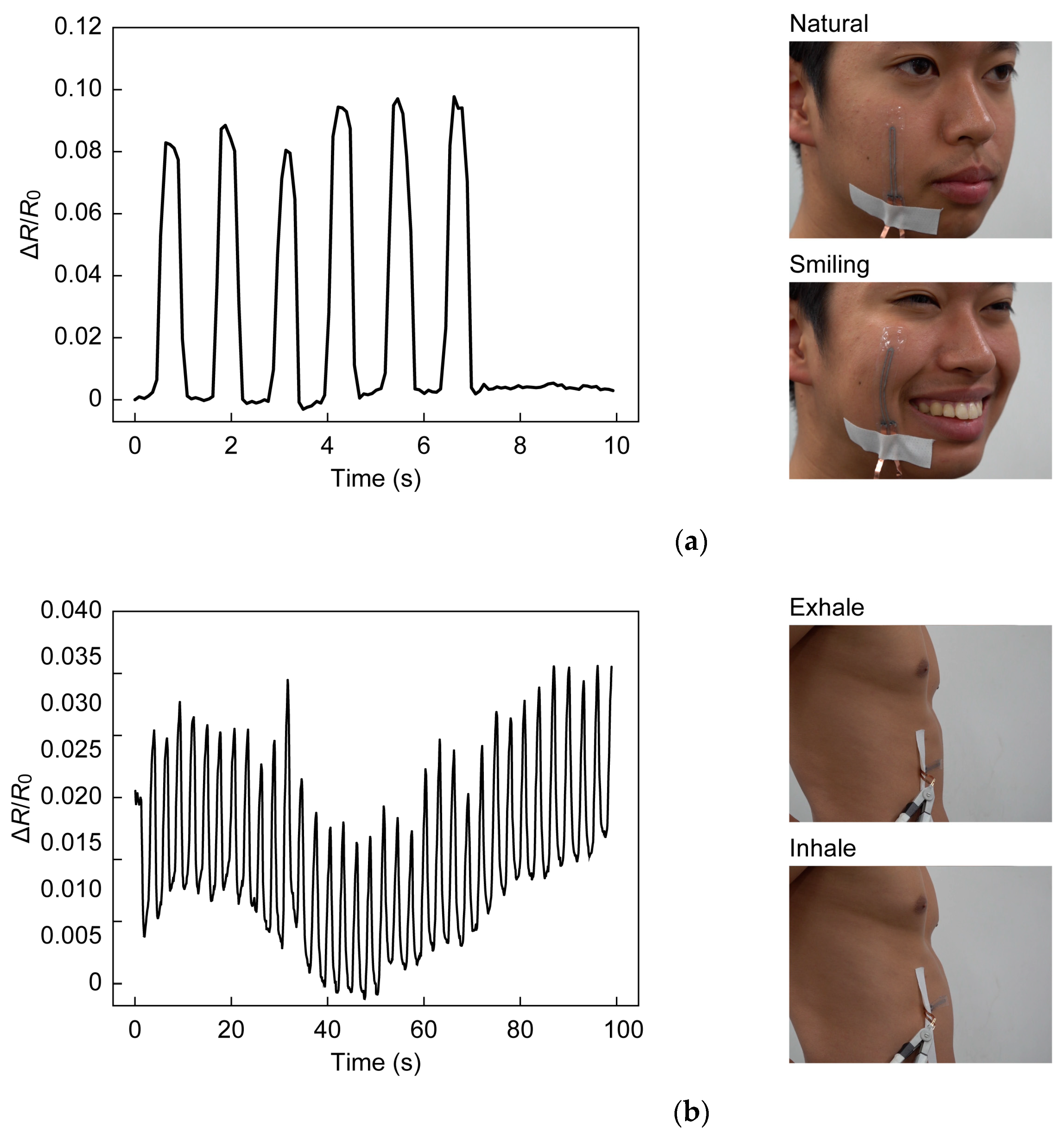 Sensors 23 01774 g012 Sensors 23 01774 g012
