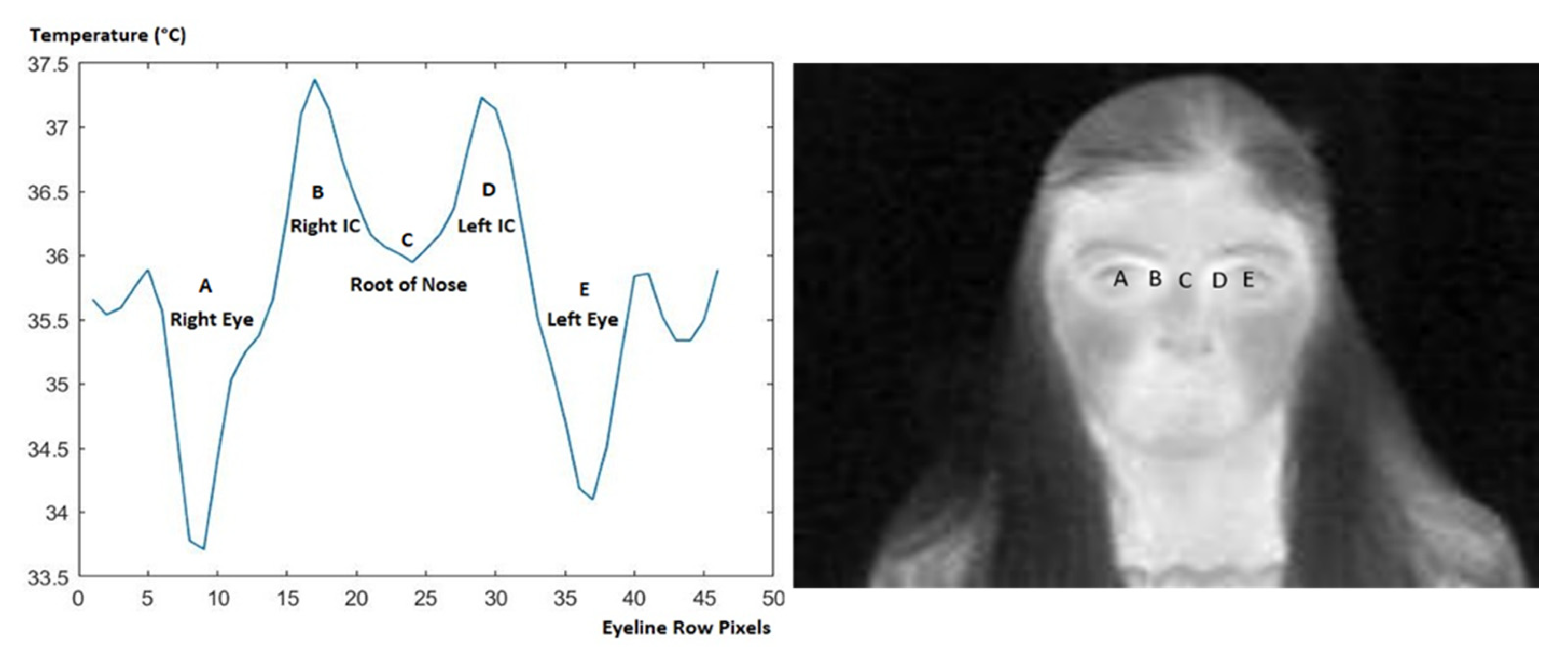 Sensors 23 01851 g016 550