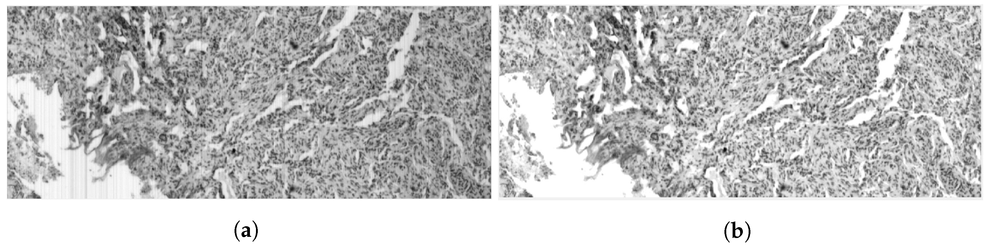 Sensors 23 01863 g005