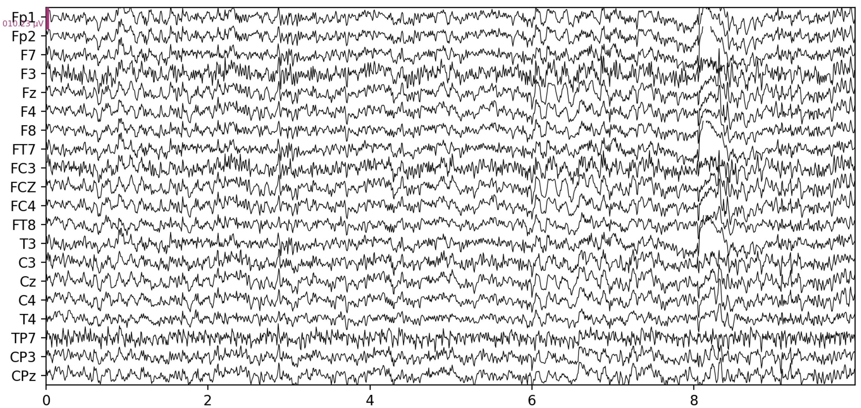 Sensors 23 01874 g002 550