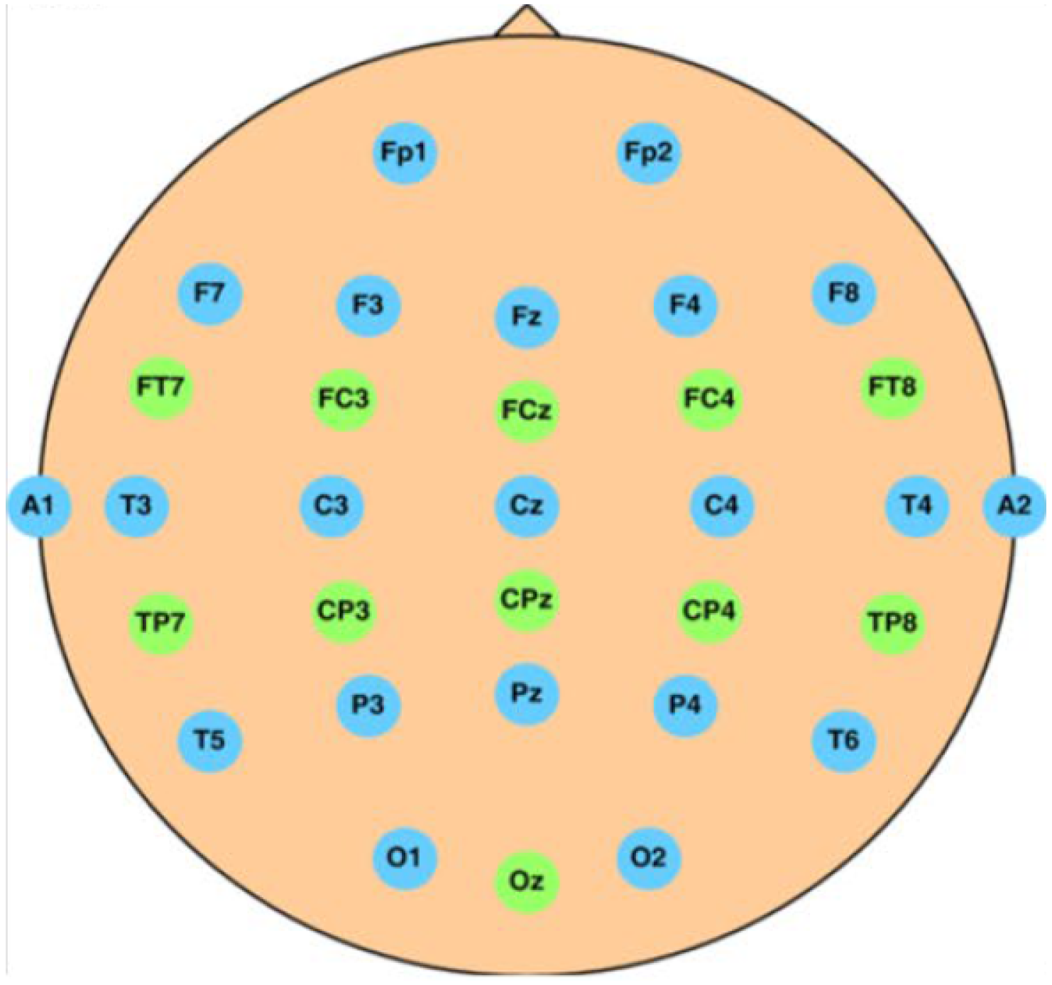 Sensors 23 01874 g006 550