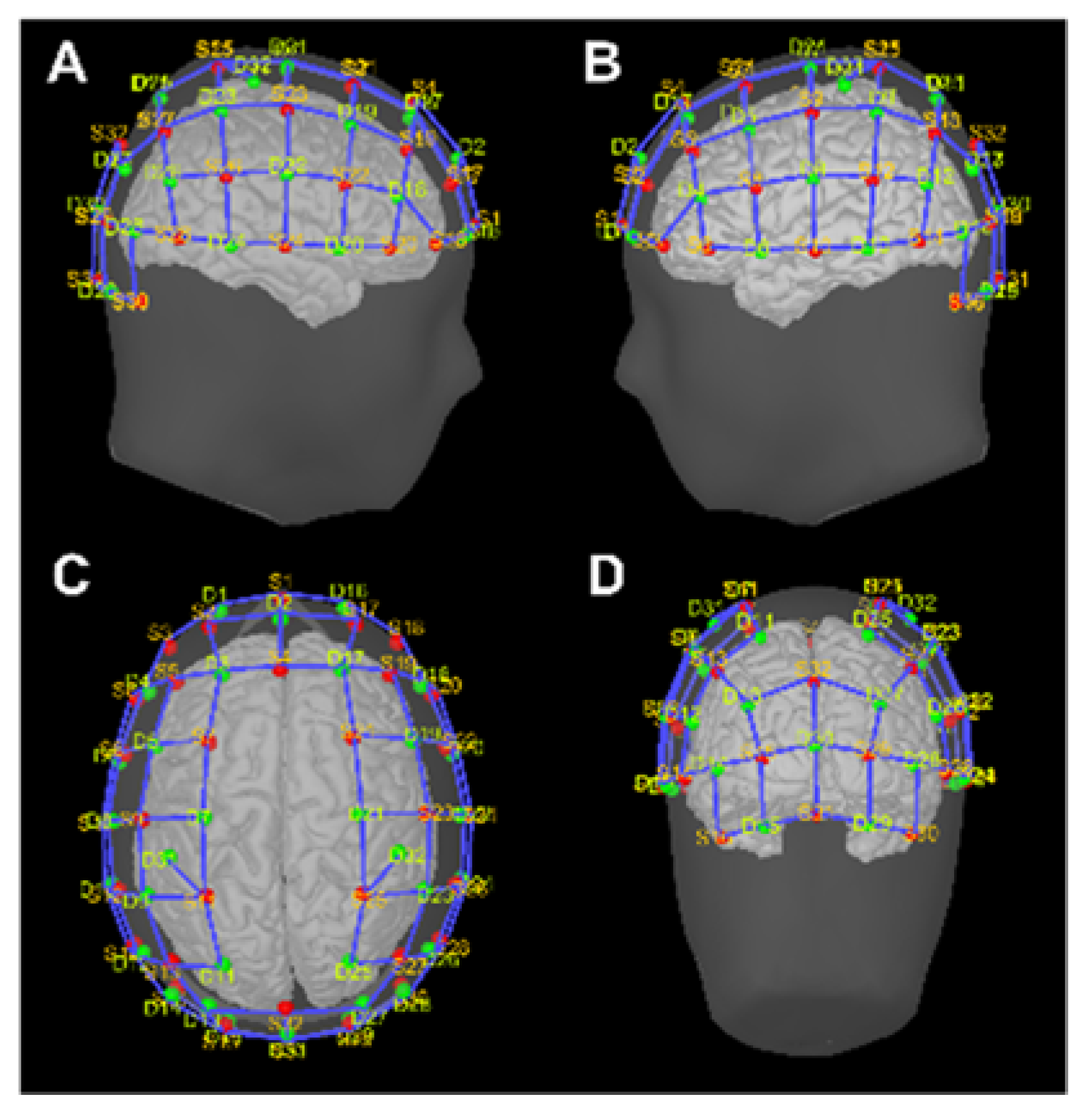 Sensors 23 02089 g001