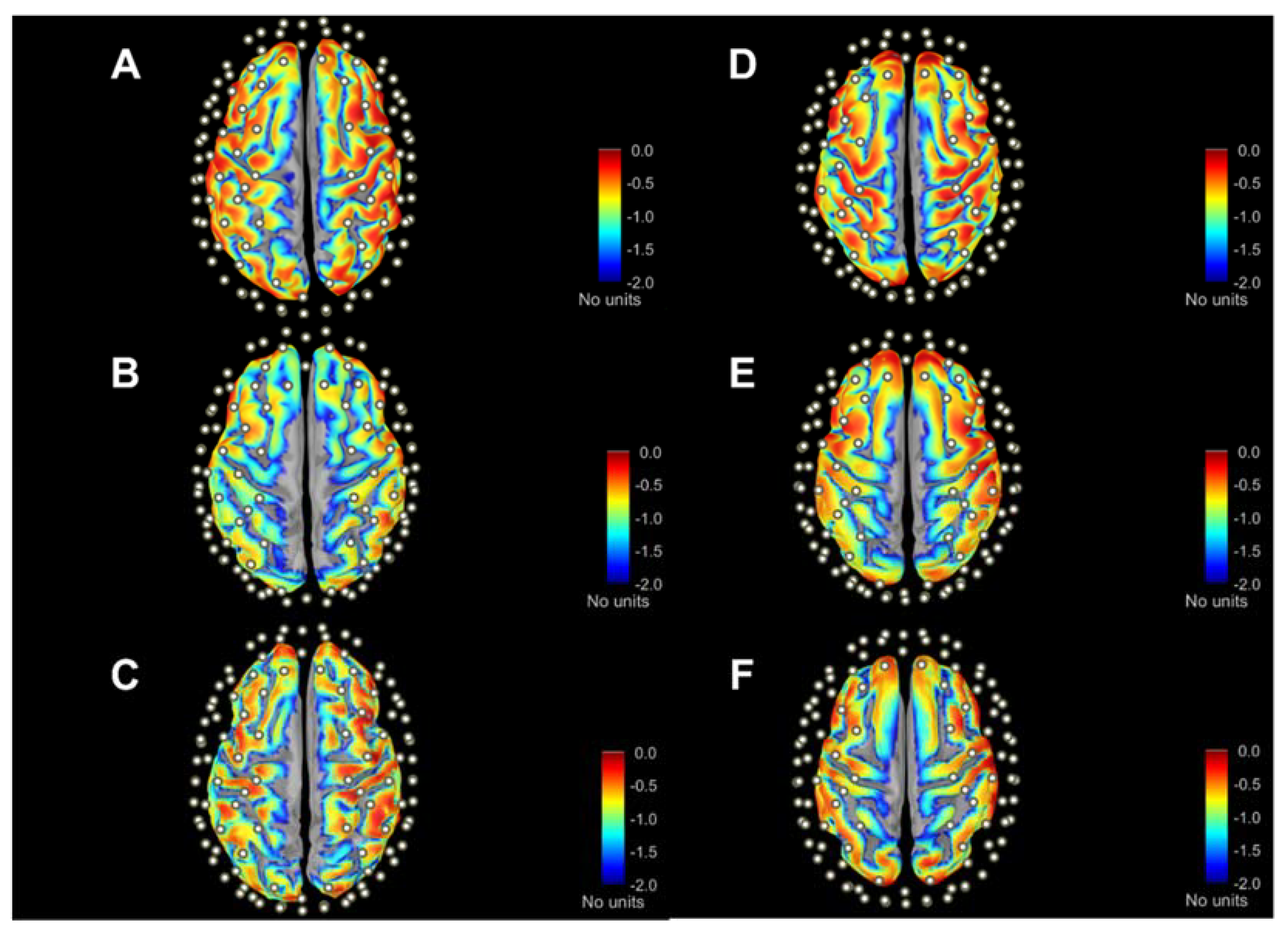 Sensors 23 02089 g004