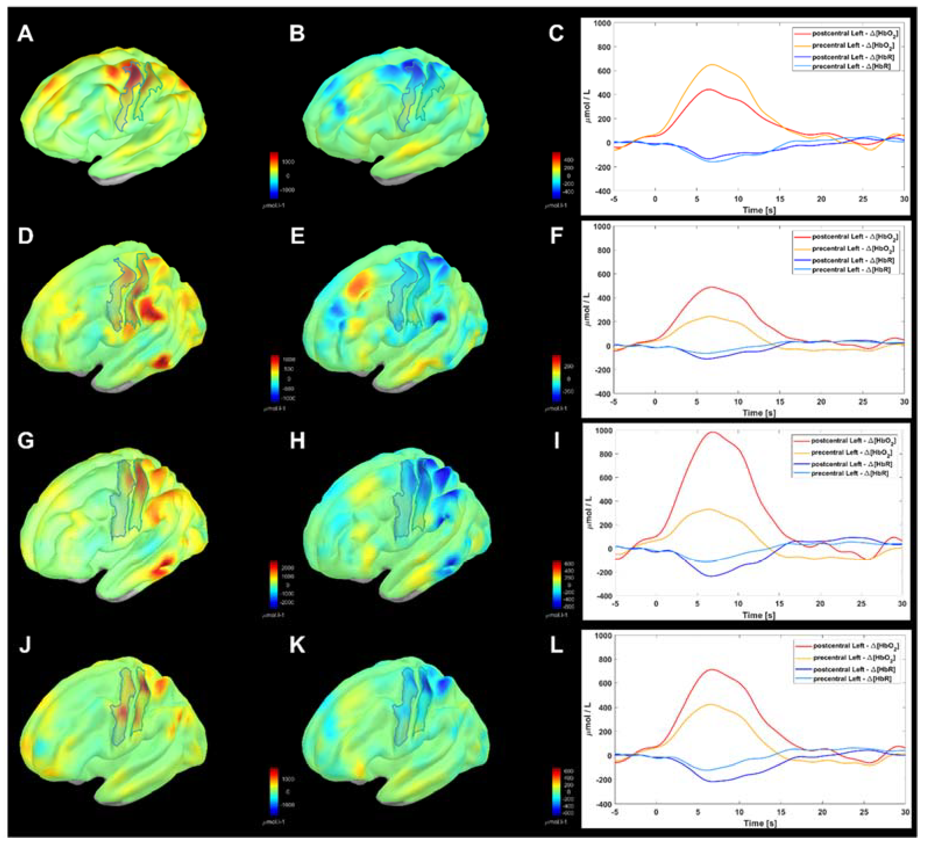 Sensors 23 02089 g006