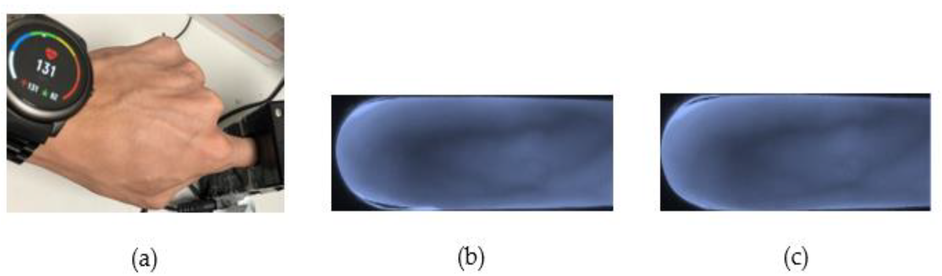 Sensors 23 02184 g017