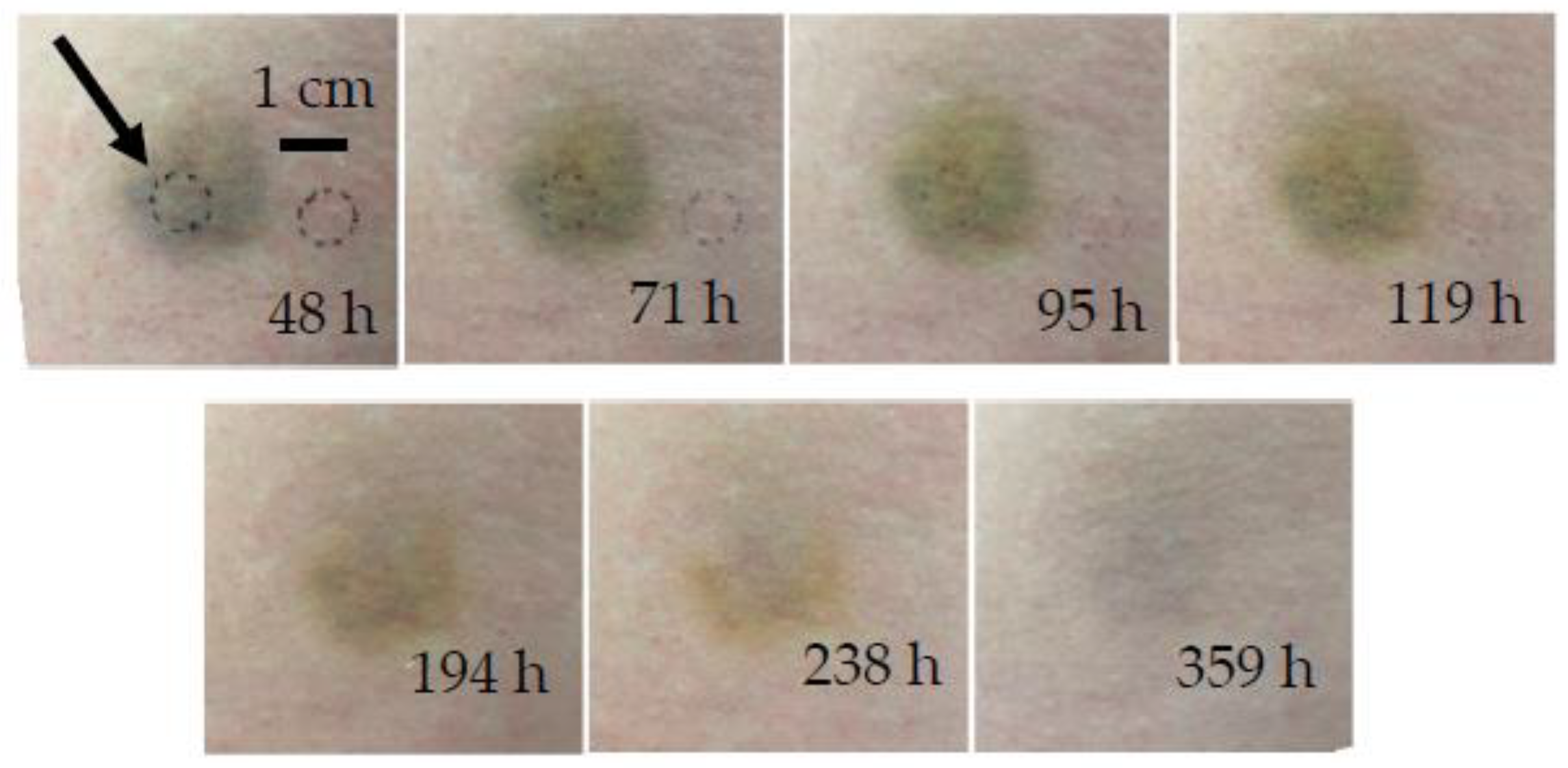 Sensors 23 02196 g004 Sensors 23 02196 g004