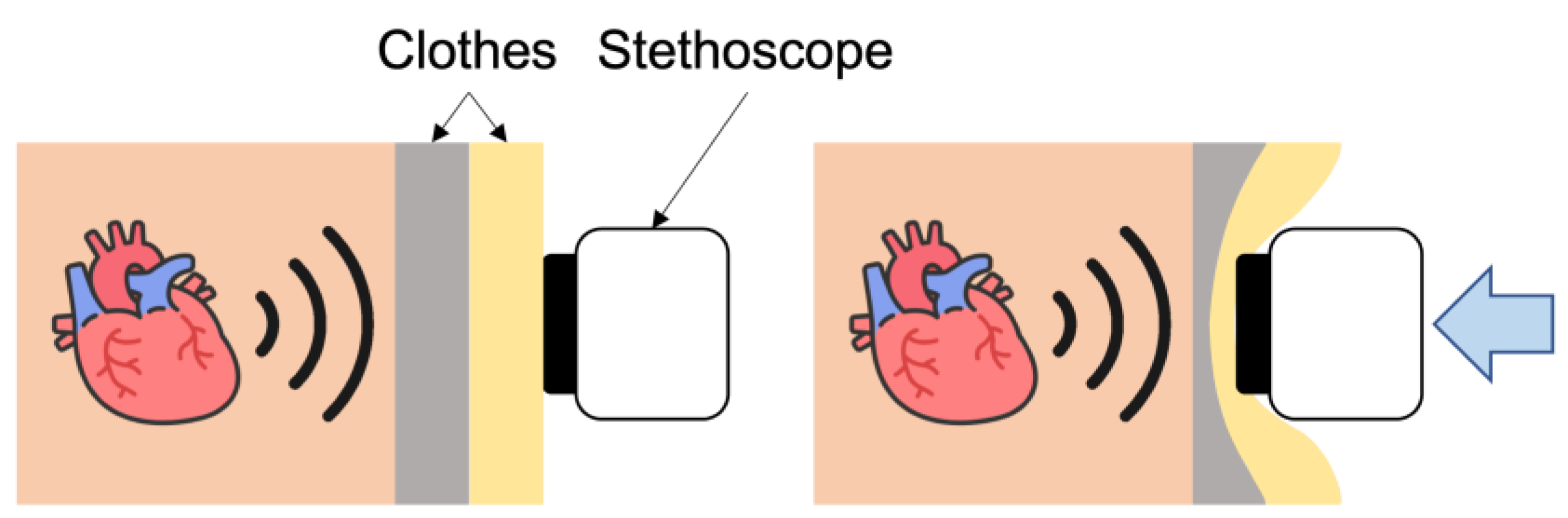 Sensors 23 02260 g001
