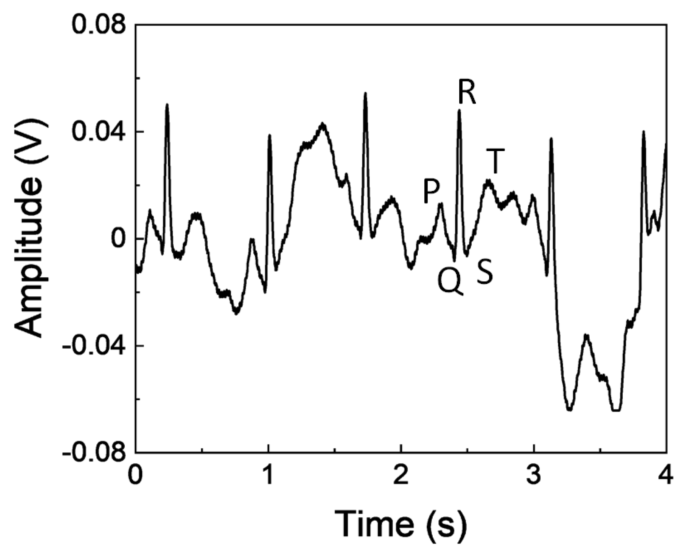 Sensors 23 02270 g008 550